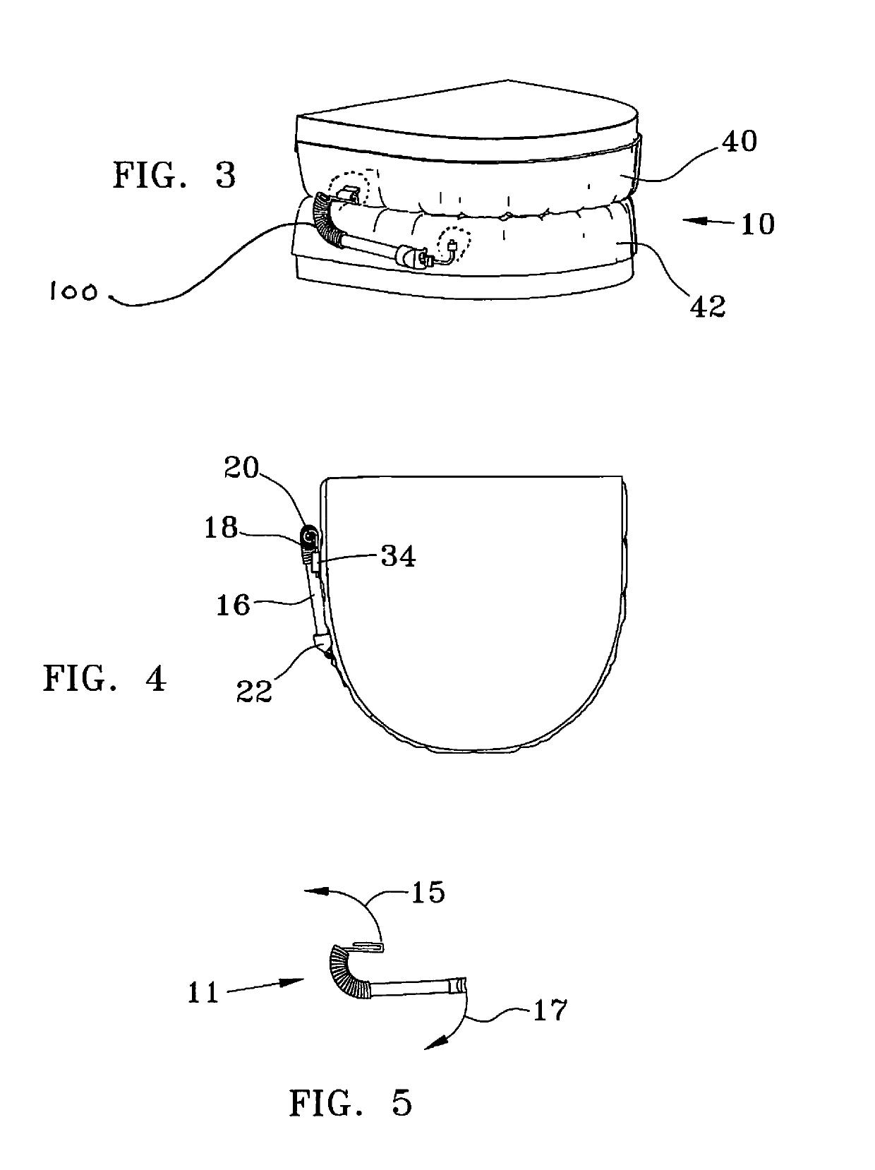 Method and apparatus for orthodontic corrections