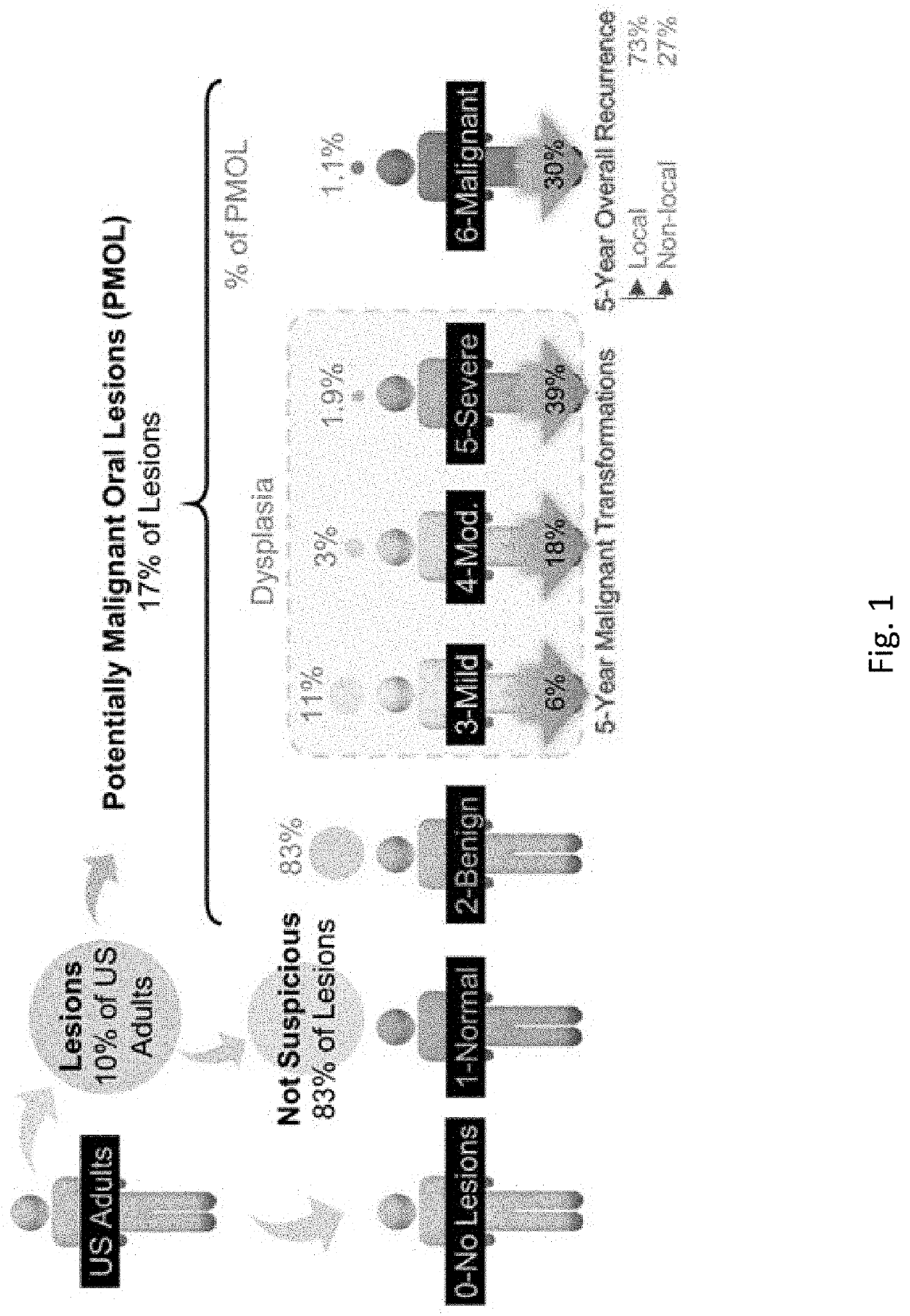 Screening and Assessment of Potentially Malignant Oral Lesions