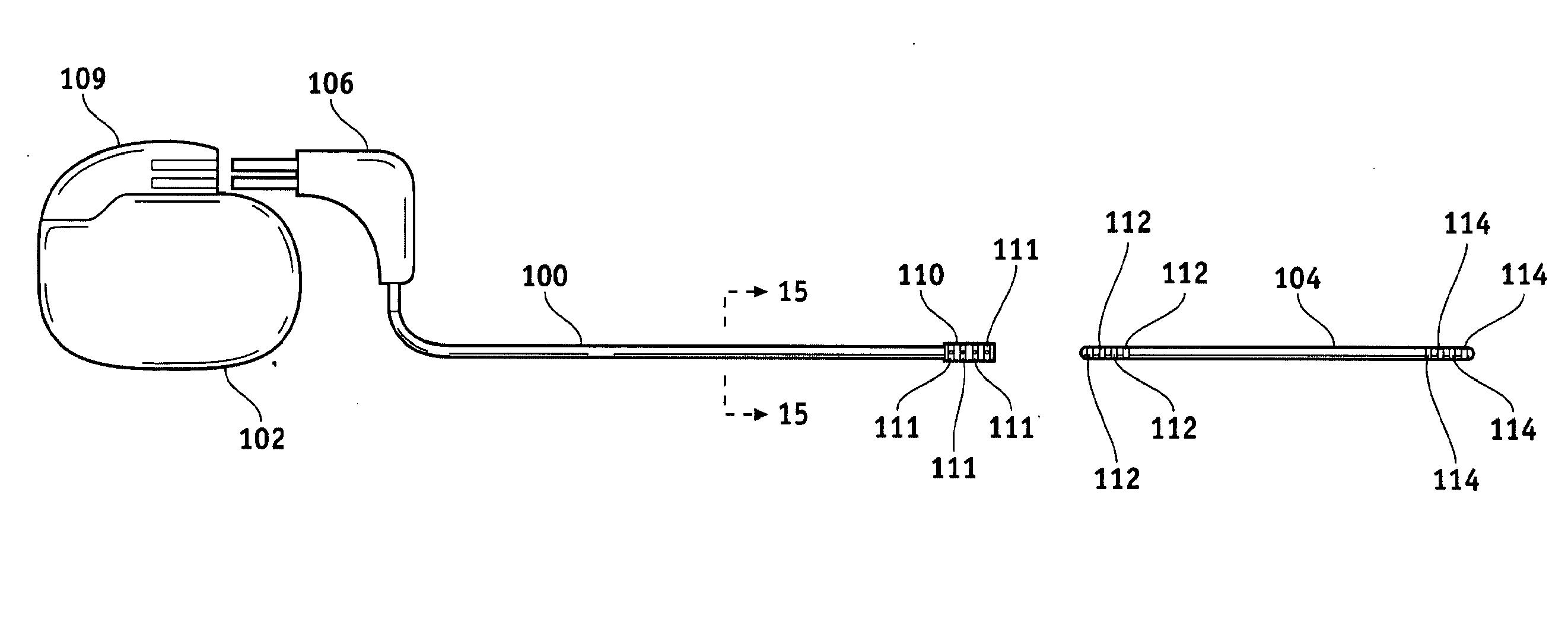 Lead Electrode for Use in an MRI-Safe Implantable Medical Device