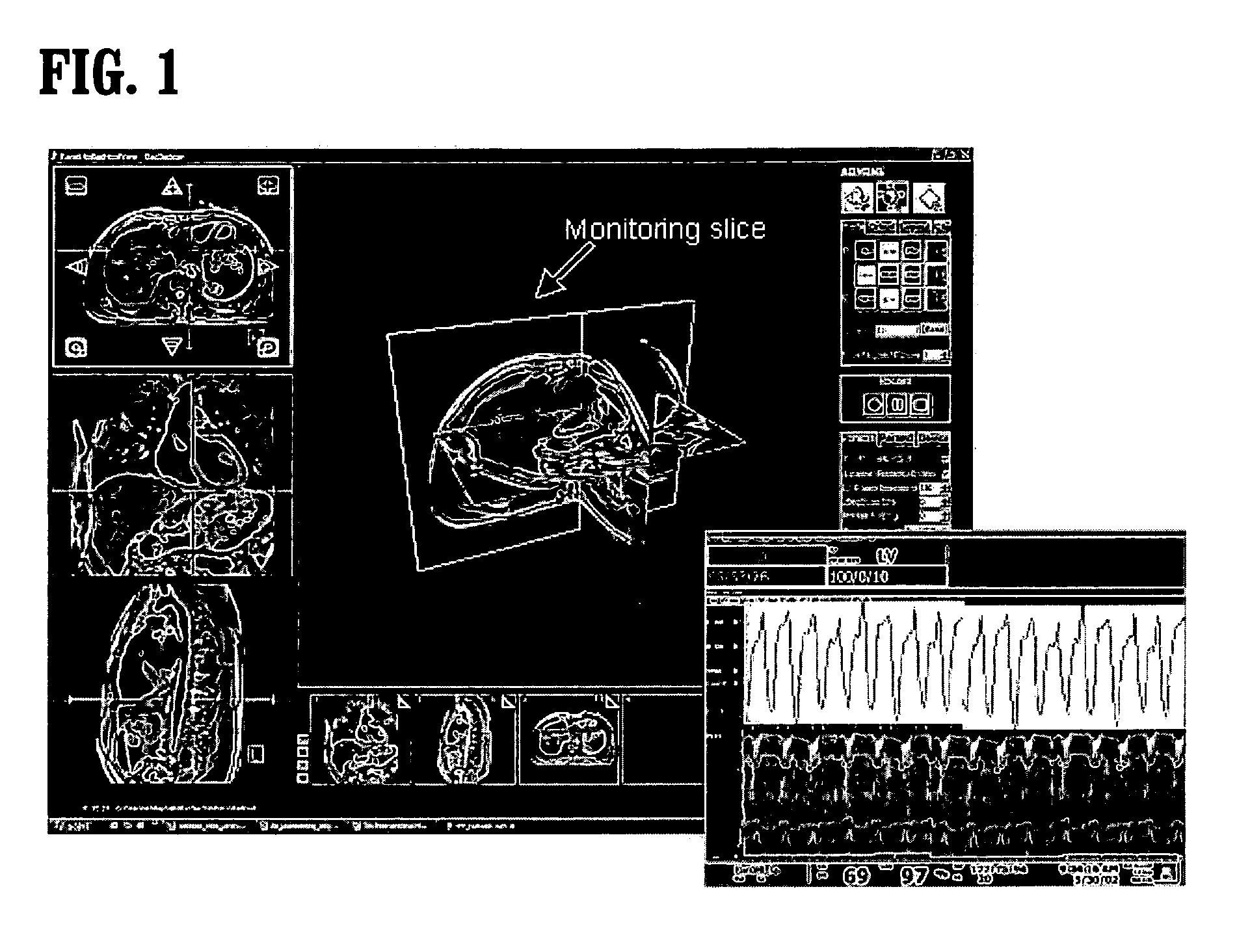 System and method for image based physiological monitoring of cardiovascular function