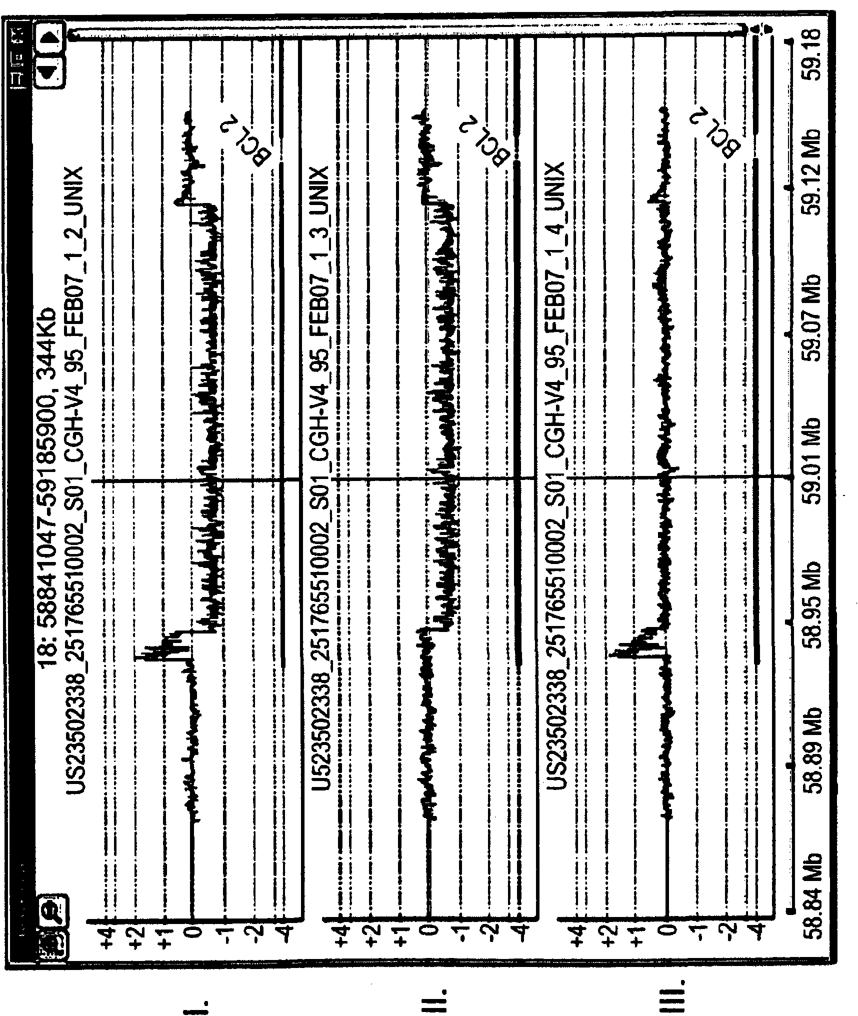 DNA microarray-based identification and localization of balanced translocation breakpoints