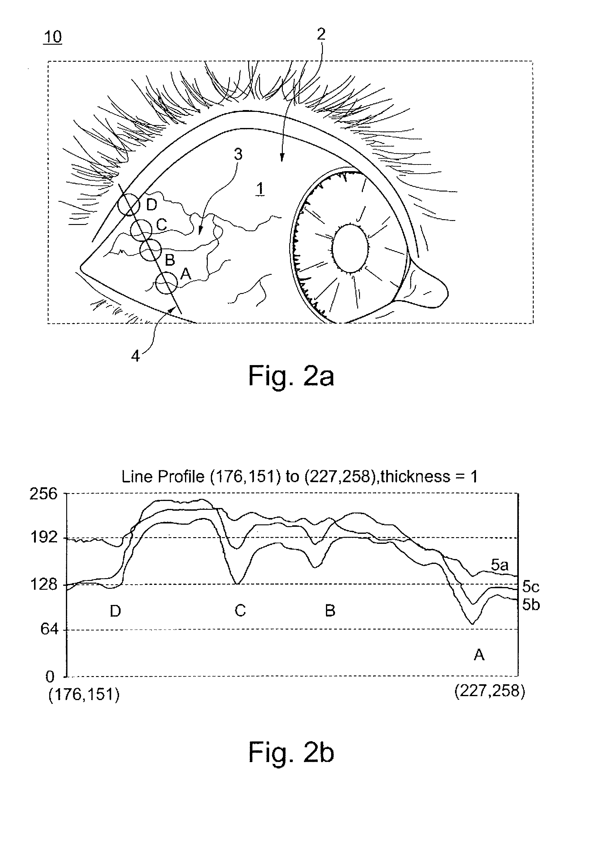 Method and device for determining the eye torsion