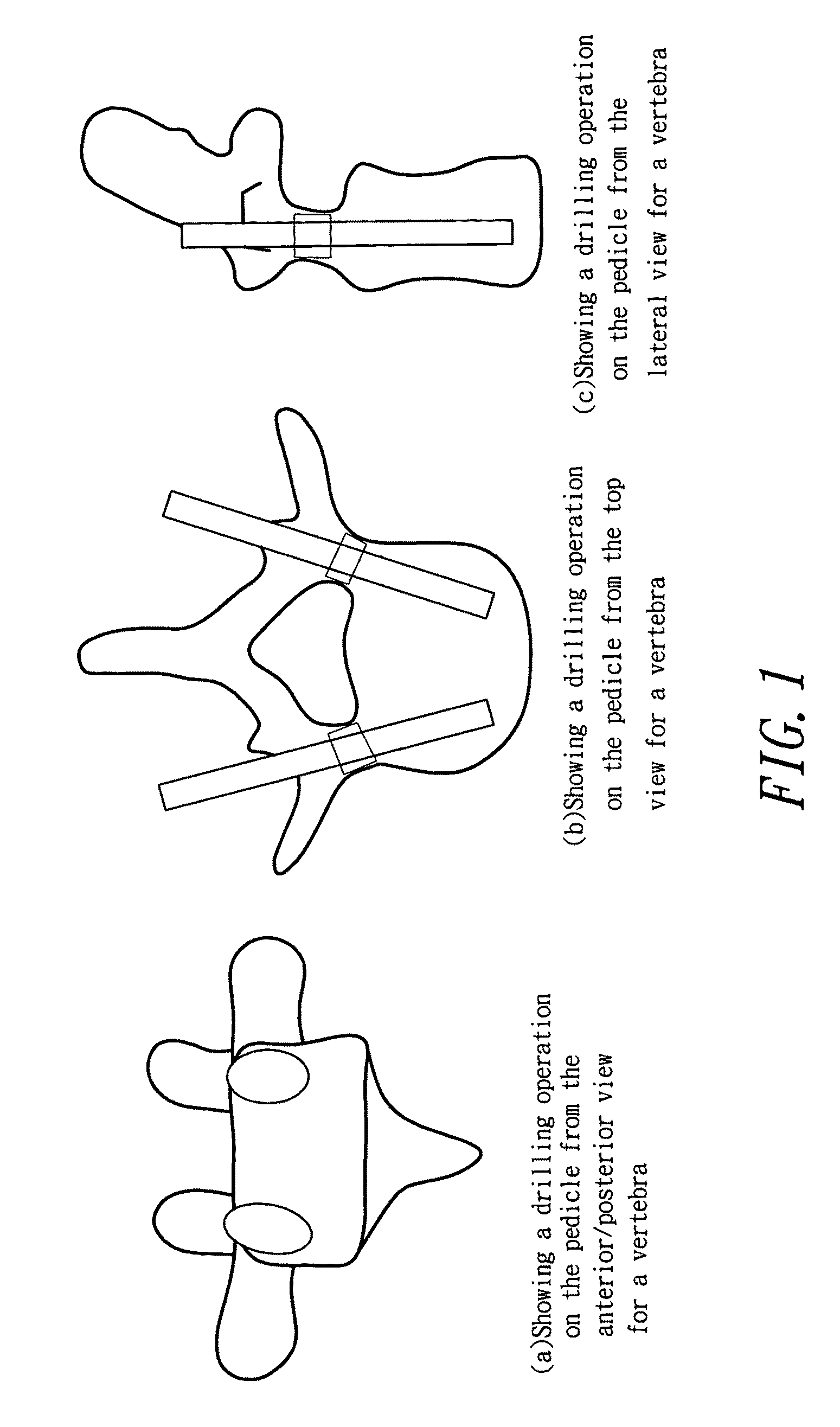 Navigation method and system for drilling operation in spinal surgery