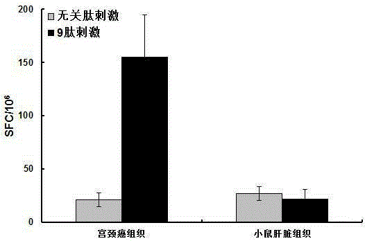 Heat shock protein complex associated with cervical cancer and application of heat shock protein complex