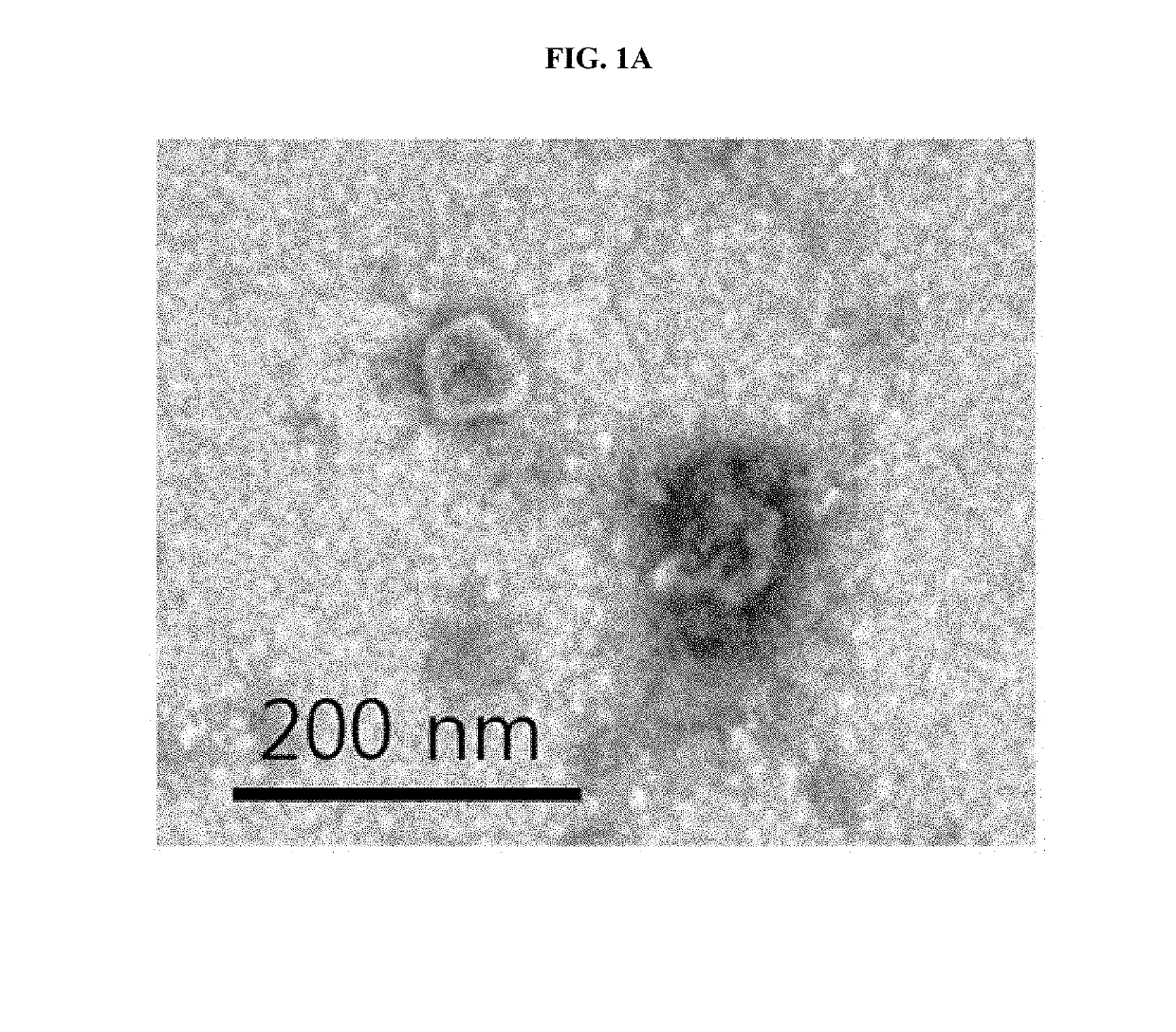 Pharmaceutical composition for prevention or treatment of pulmonary disease including mesenchymal stem cell-derived artificial nanosomes