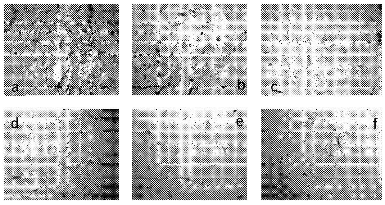 Compositions and methods for preventing and treating heterotopic ossification and pathologic calcification