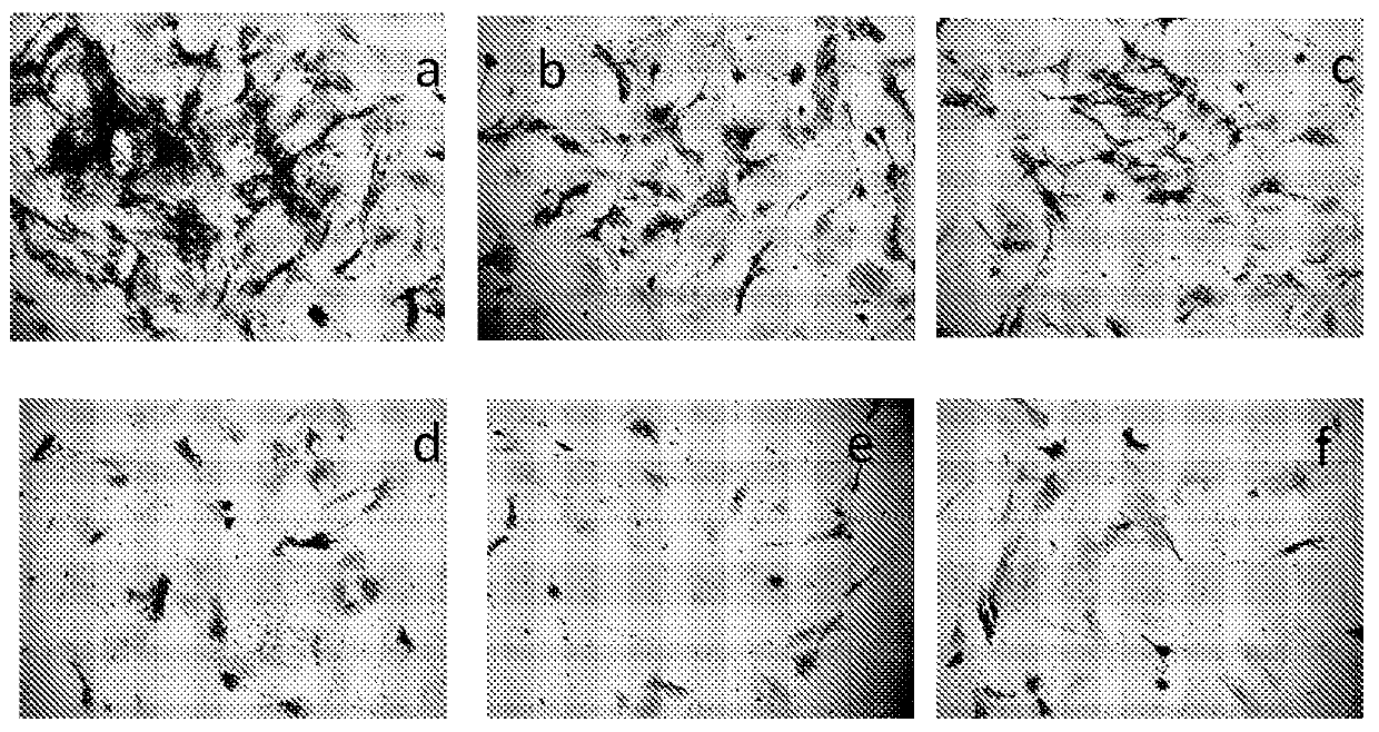 Compositions and methods for preventing and treating heterotopic ossification and pathologic calcification