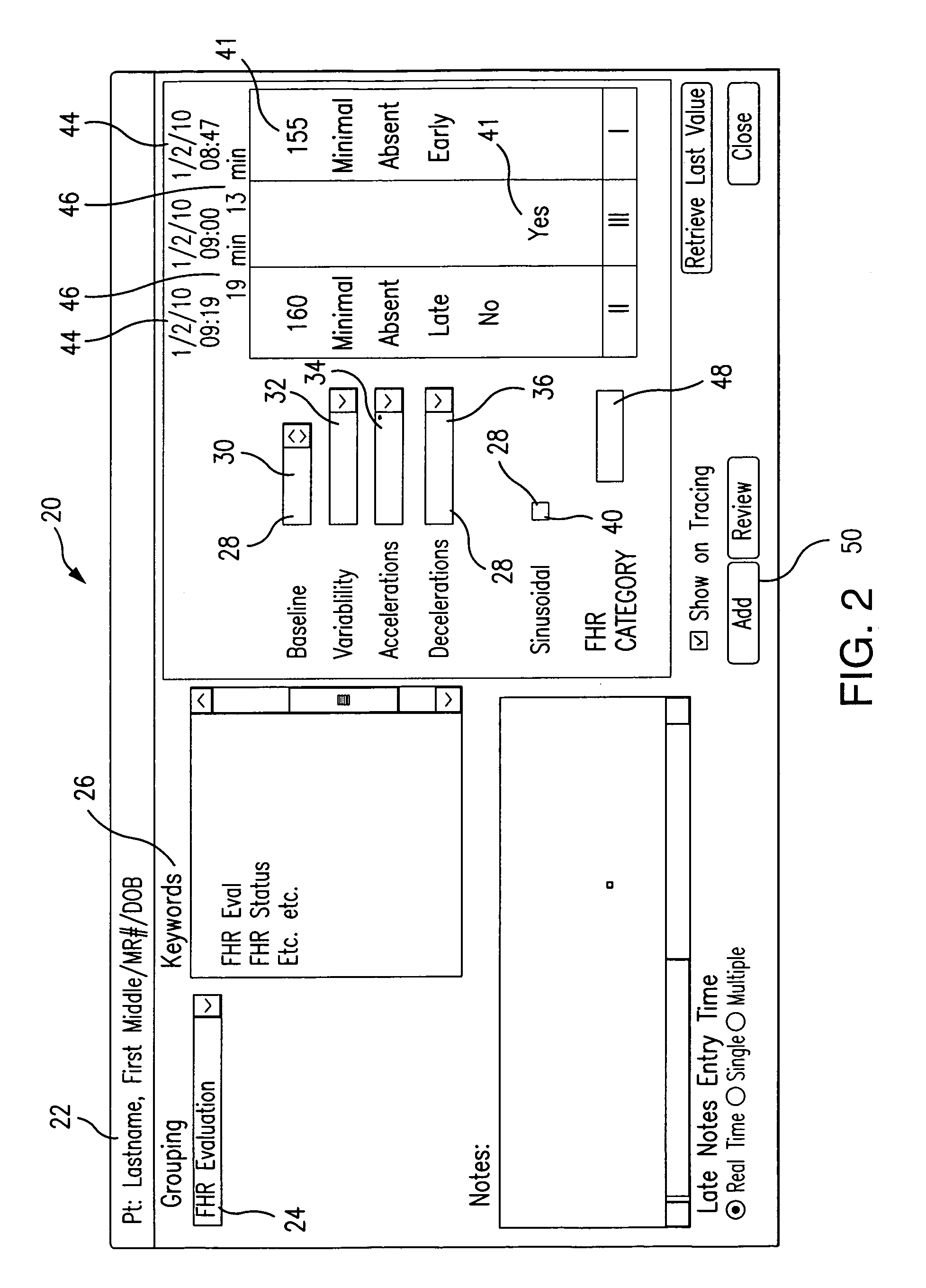 Automatic categorization of fetal heart rate information