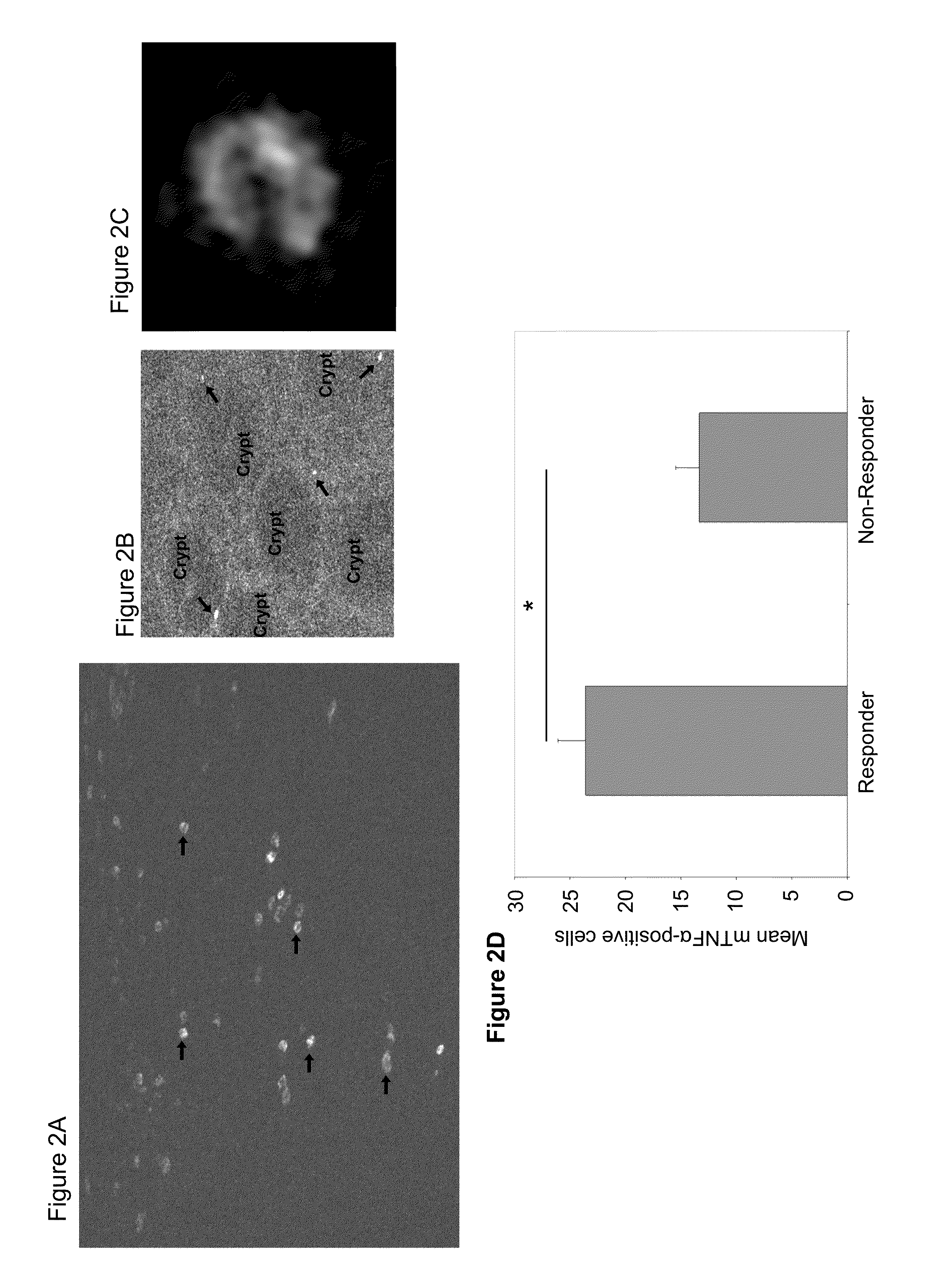 Methods and compositions for determining responsiveness to treatment with a tnf-alpha inhibitor