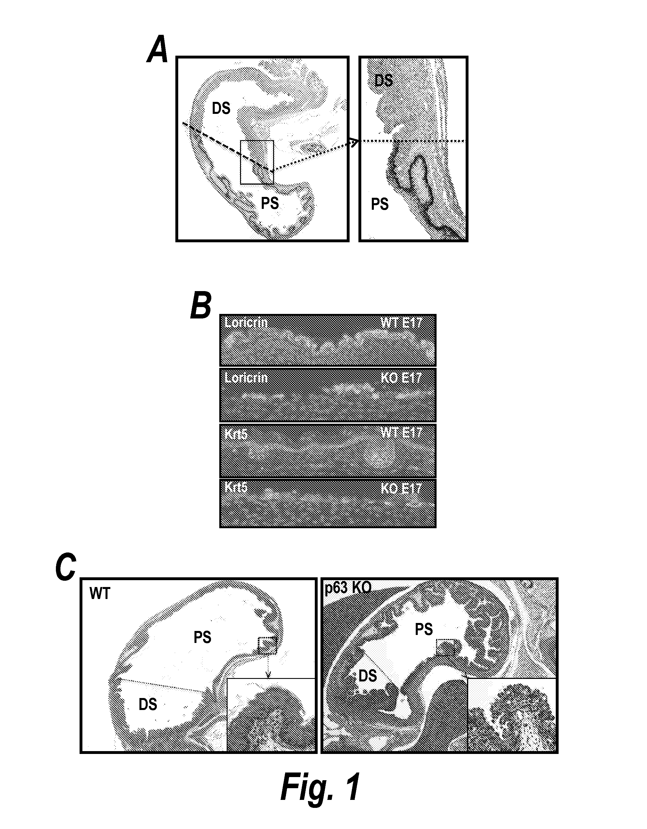 Methods and reagents for detection and treatment of esophageal metaplasia