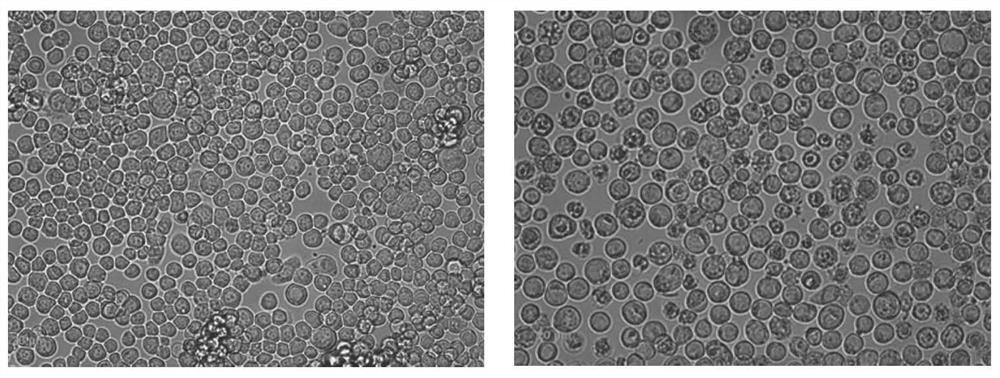 Blocking ELISA antibody detection kit based on EHDV core-like particles, preparation method and application