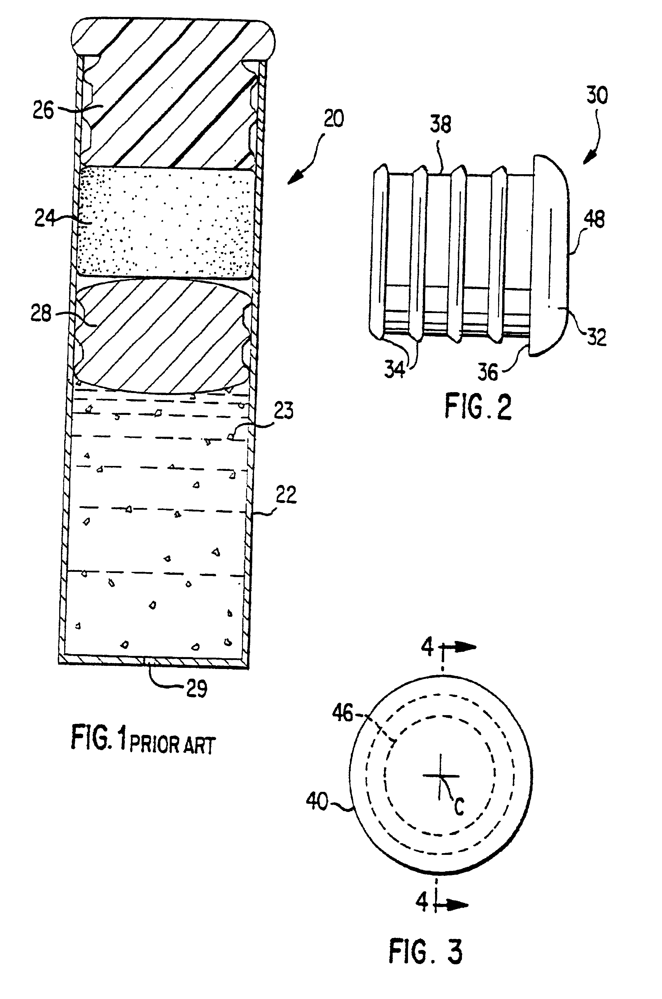 Osmotic delivery system, osmotic delivery system semipermeable body assembly, and method for controlling delivery rate of beneficial agents from osmotic delivery systems
