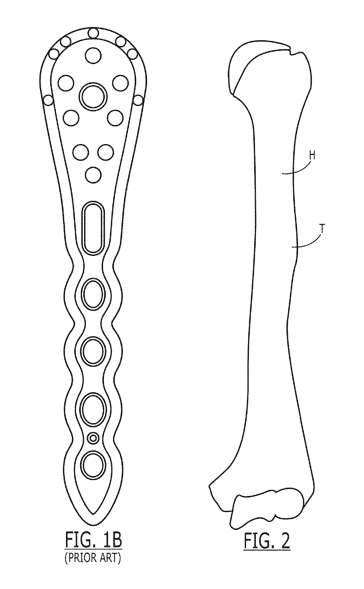 Proximal humeral fracture plate