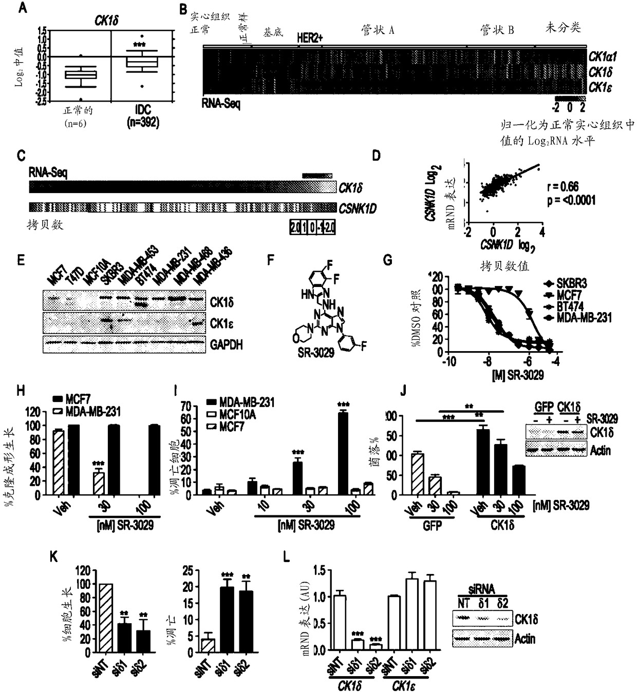 Therapeutic targeting of casein kinase 1deta in breast cancer