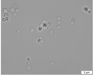 A strain of Rhodotorula biobversus producing carotenoids and its application