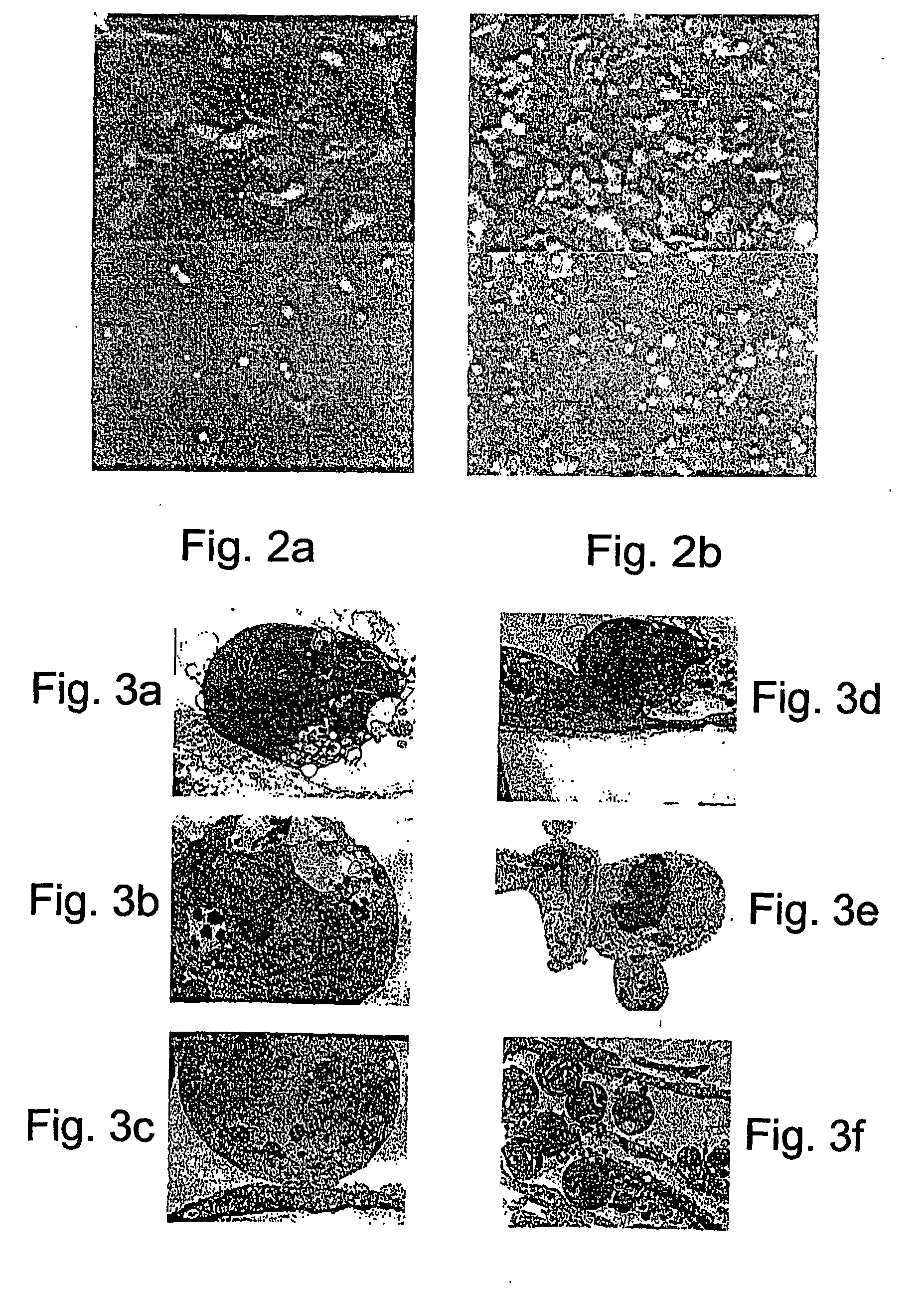 Polynucleotide constructs, pharmaceutical compositions and methods for targeted downregulation of angiogenesis and anticancer therapy