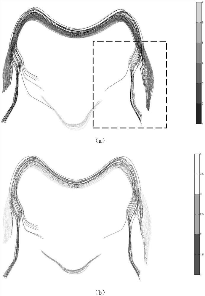 A Clustering Method of Cerebral White Matter Fiber Tracts Based on Fiber Midpoints and Endpoints