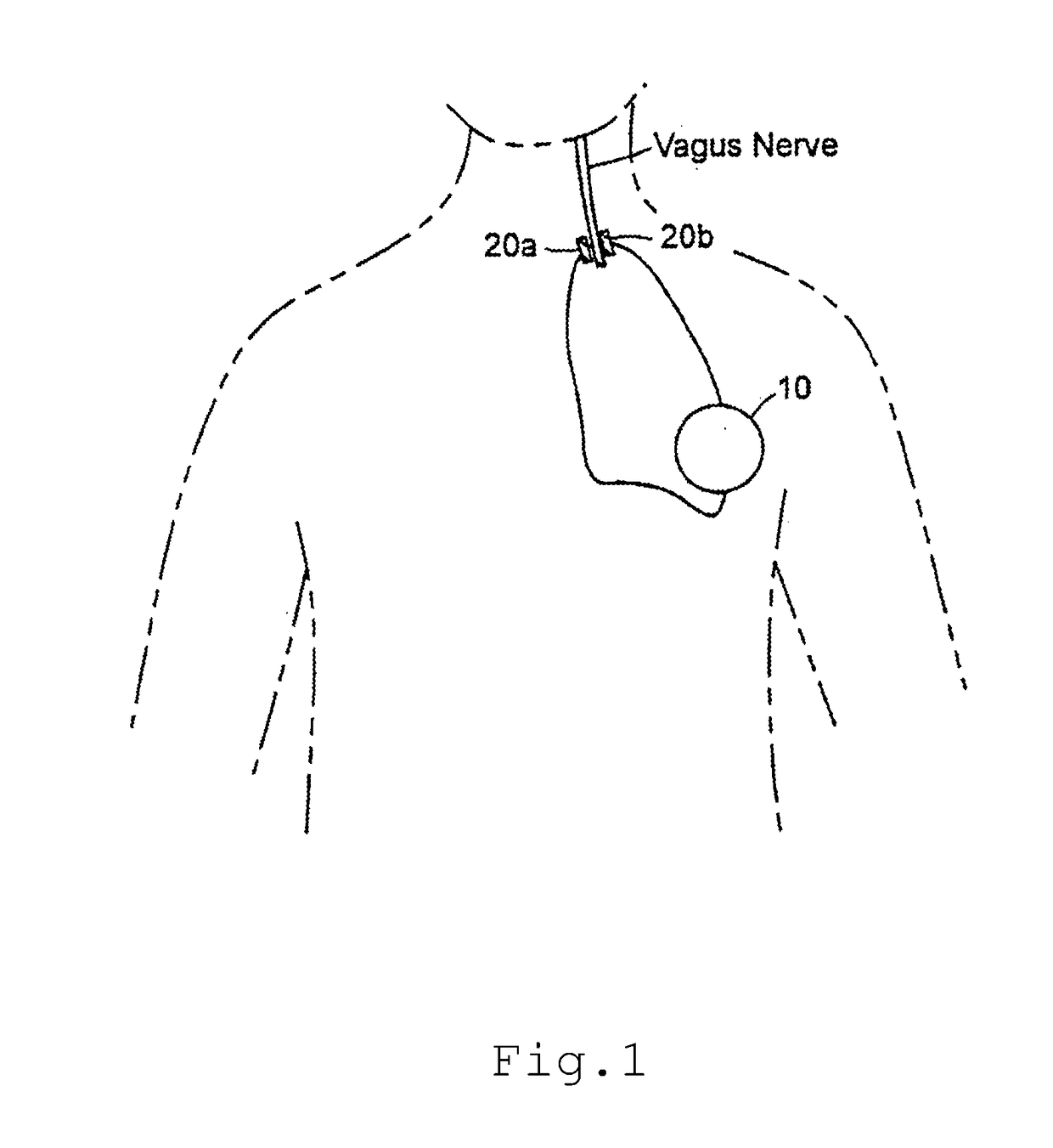 System and method for improving emotional well-being by vagal nerve stimulation