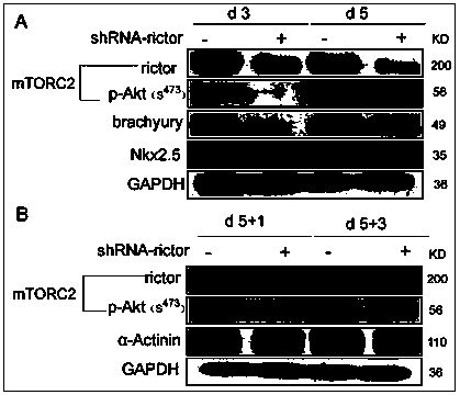 Pharmaceutical application of Rictor/mTORC2 in heart development and disease treatment