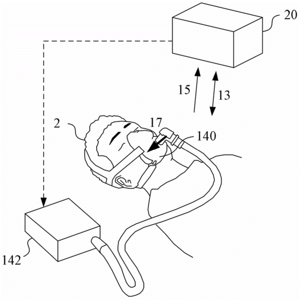 Respiration assistance system and method