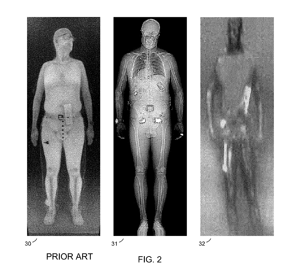 Body Scanner with Reference Database