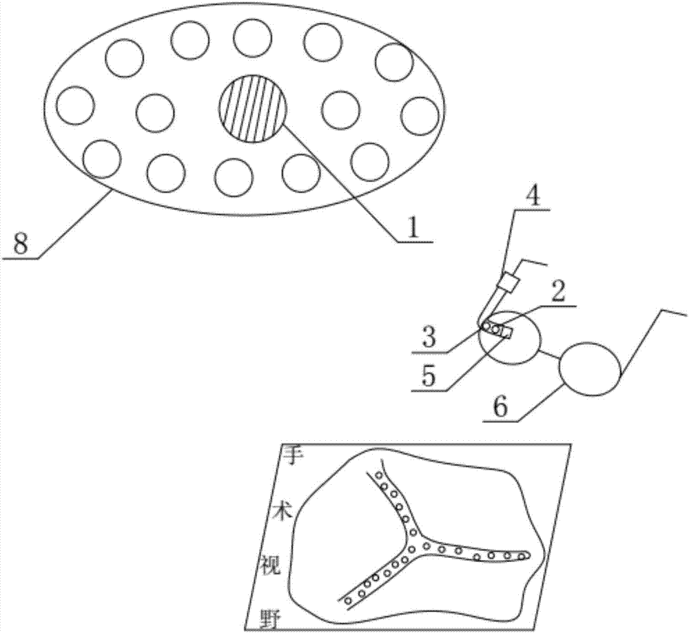 Optical navigation system for surgeries