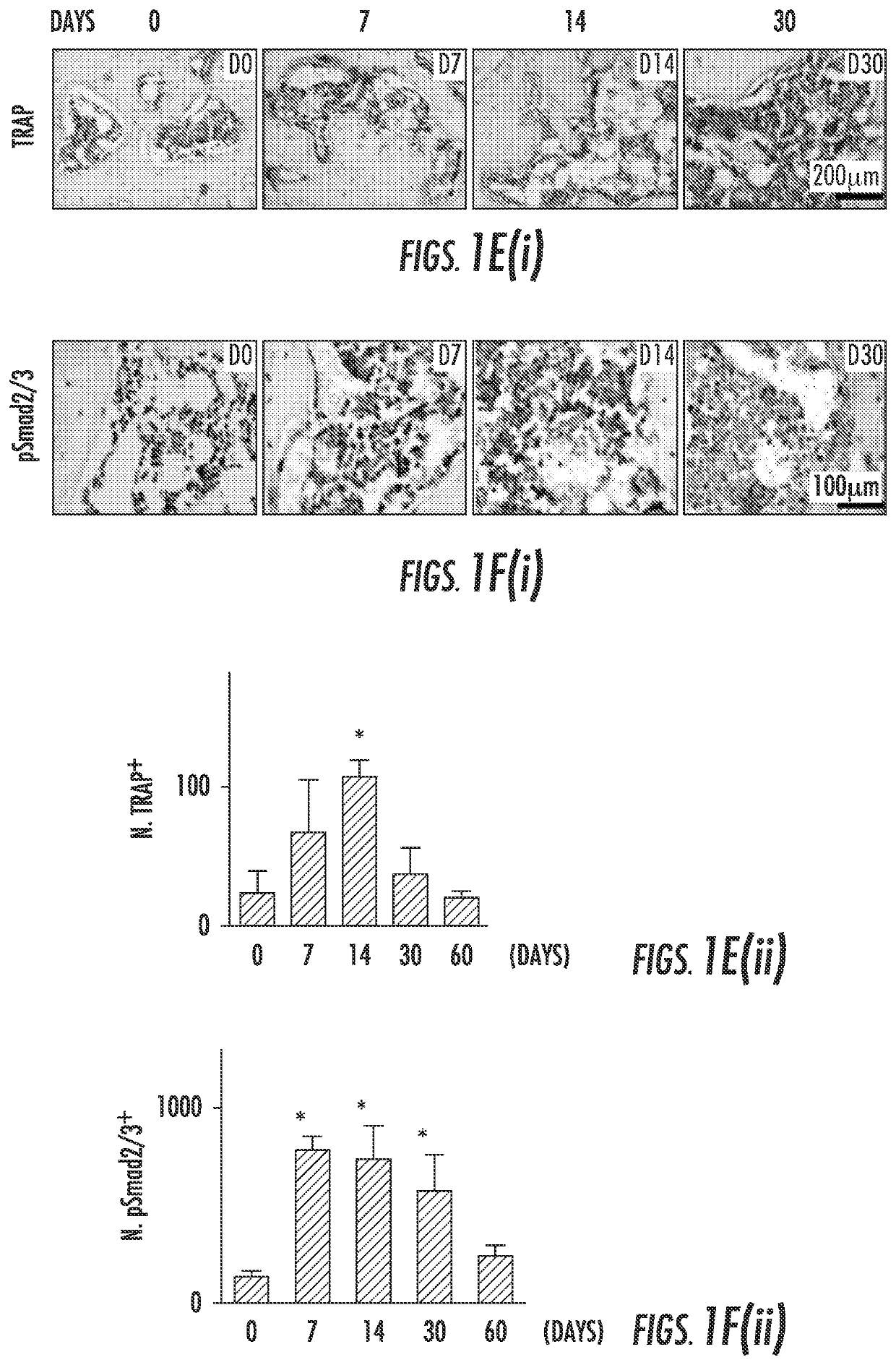 Compositions and methods for treating or preventing osteoarthritis