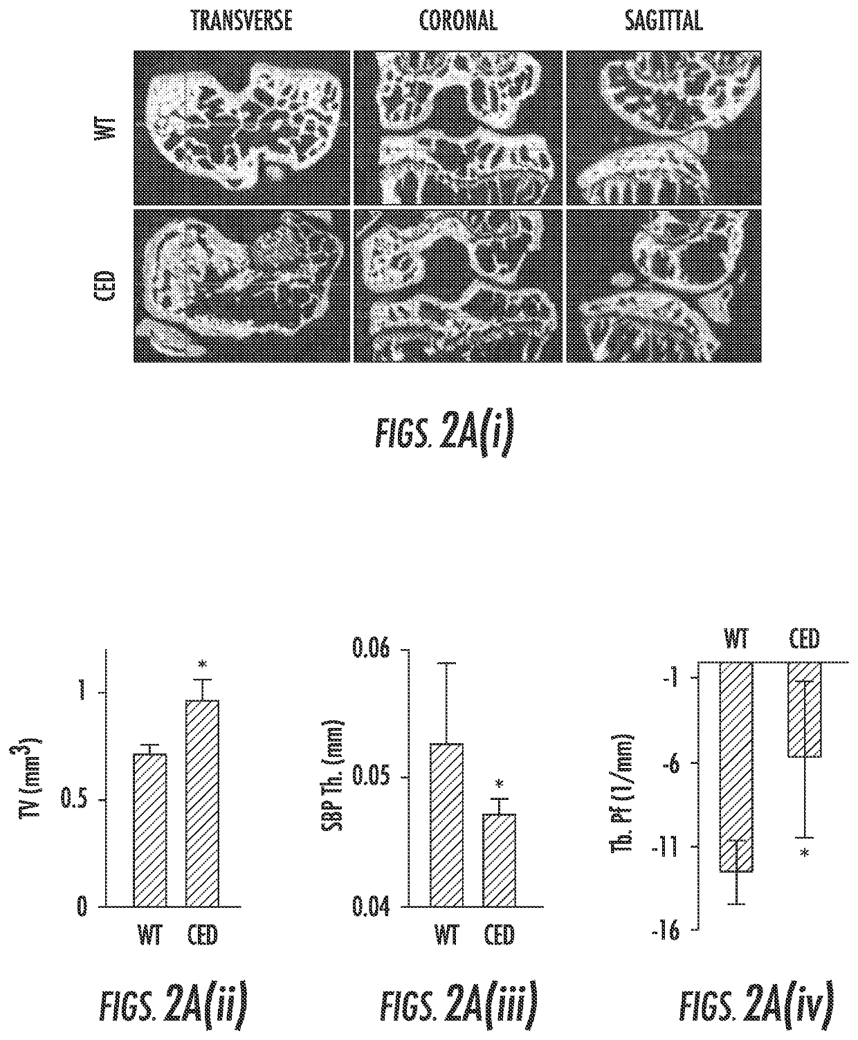 Compositions and methods for treating or preventing osteoarthritis