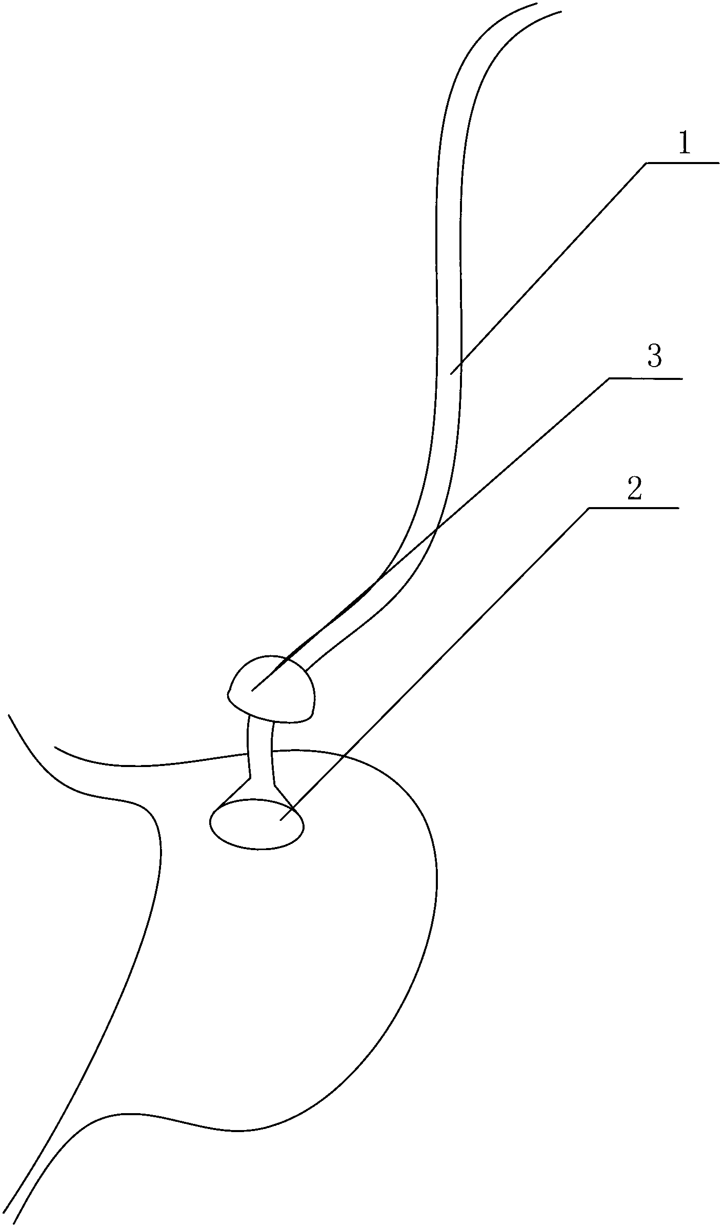 Method for preparing mouse gastric intubation model