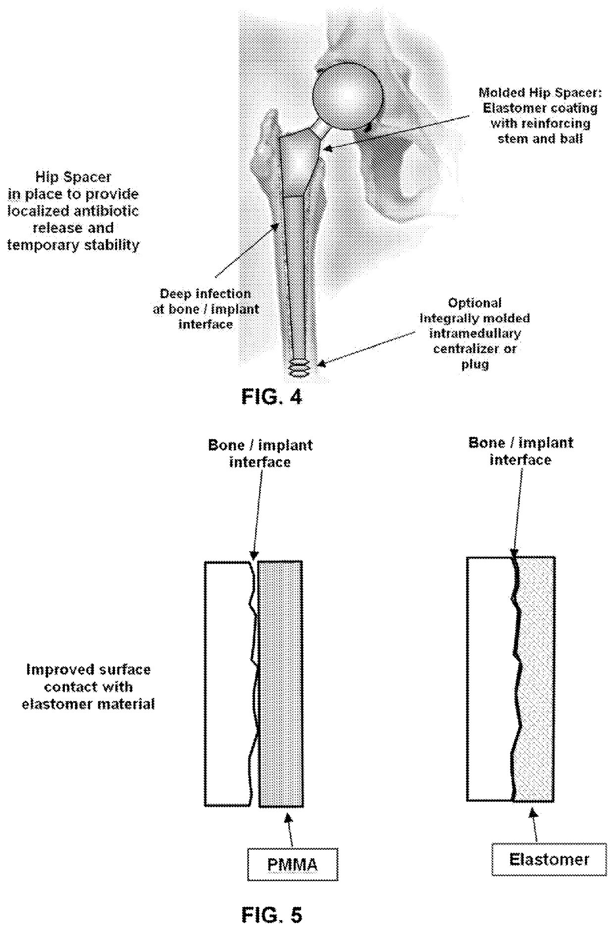 Method and apparatus for using elastomeric materials in surgical applications