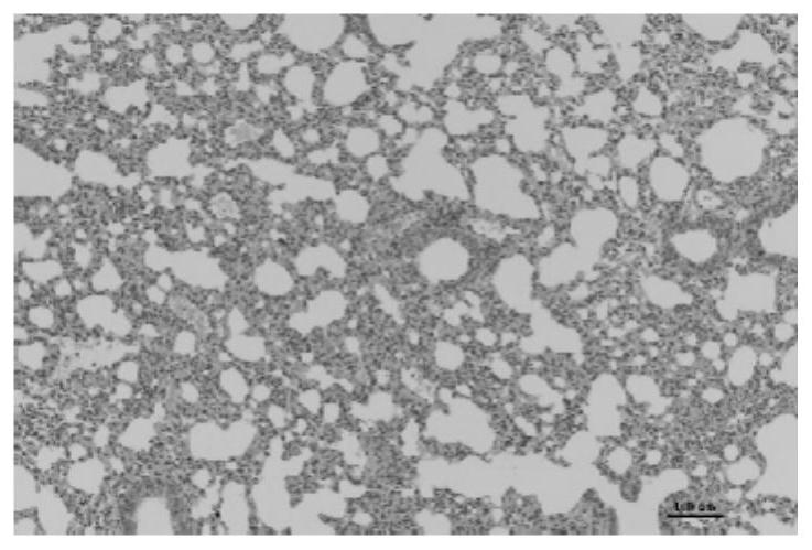 Application of traditional Chinese medicine composition in preparation of anti-inflammatory medicine and/or immunomodulatory medicine