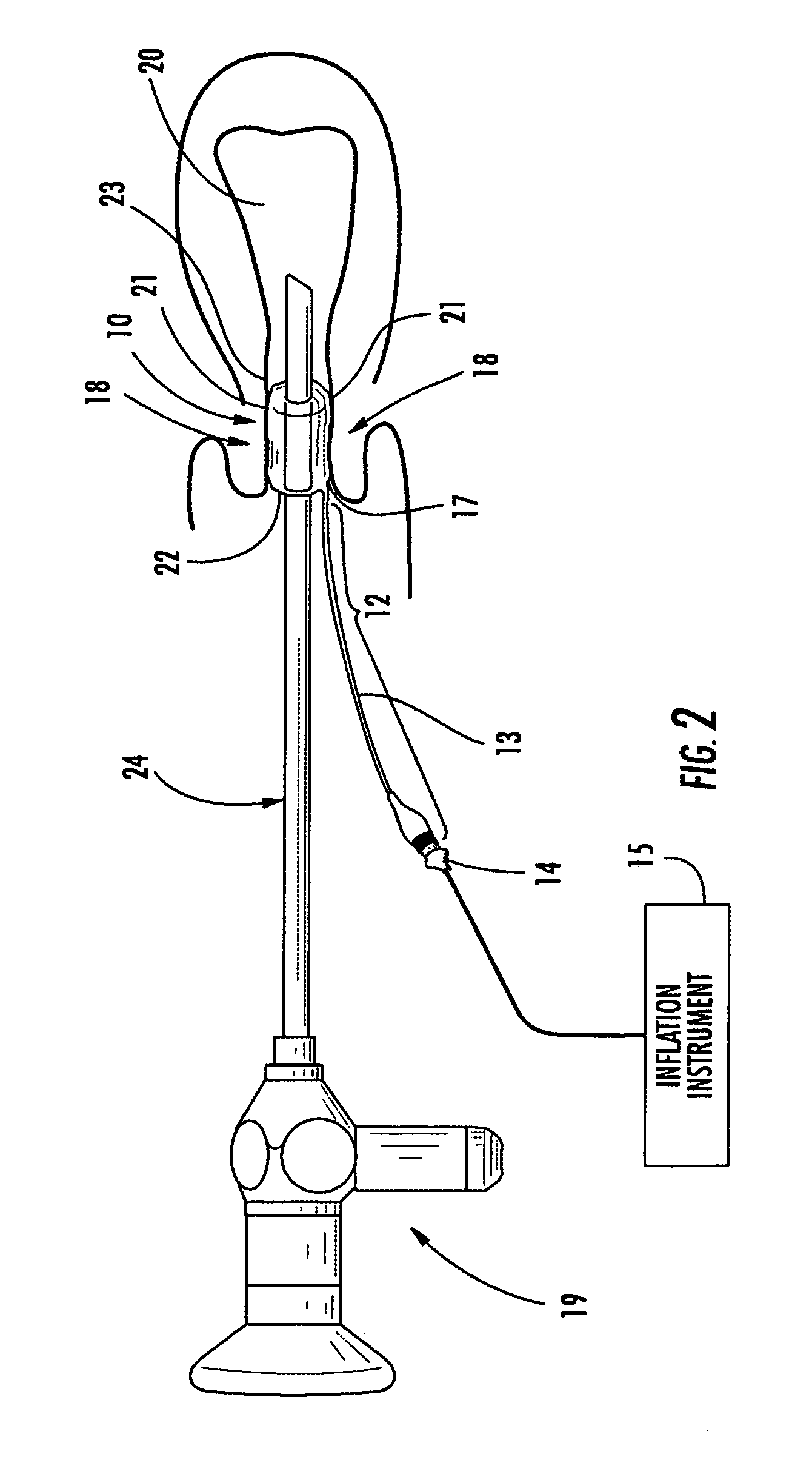 Device for sealing a body canal and method of use