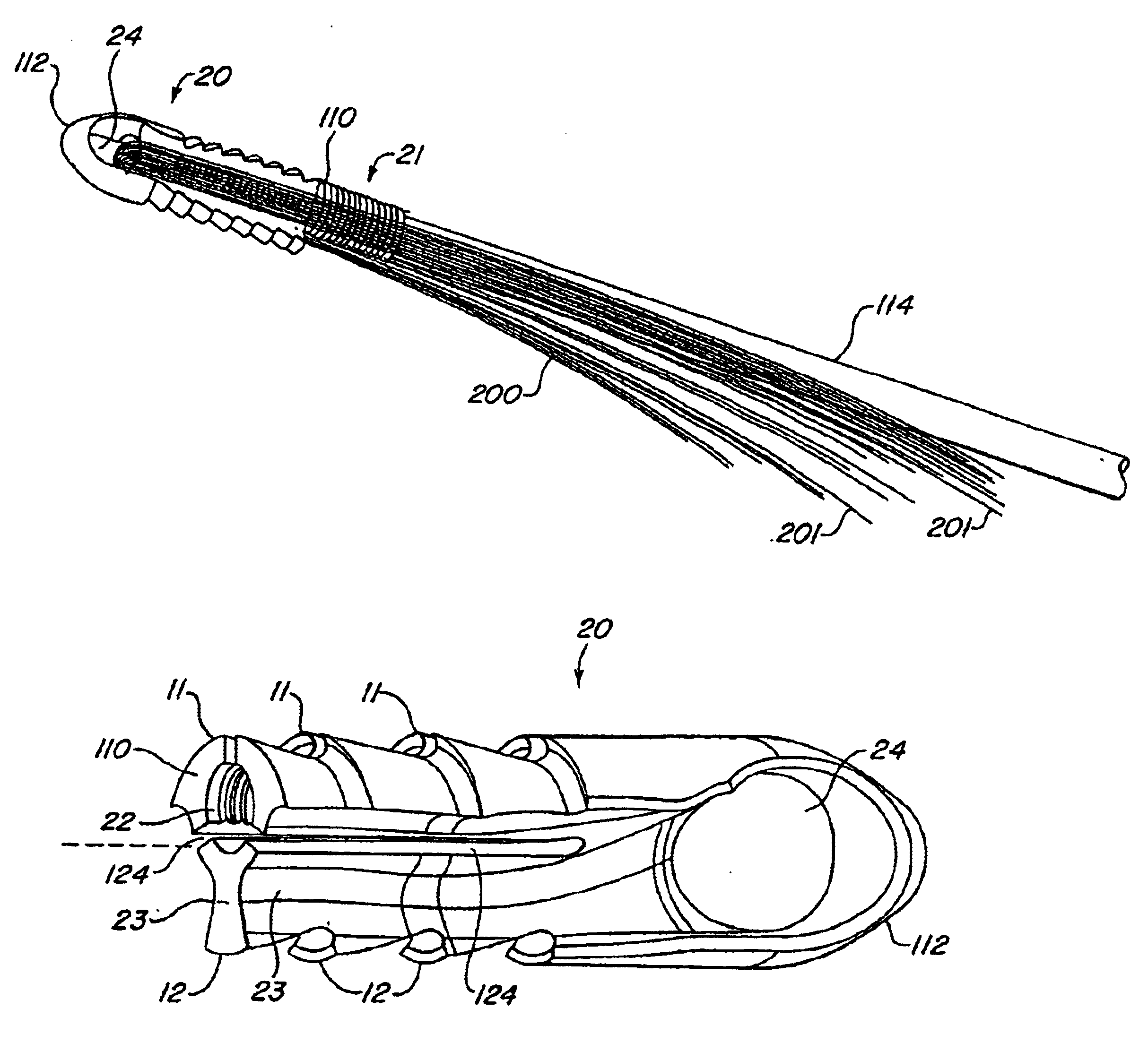 Expanding ligament graft fixation system and method