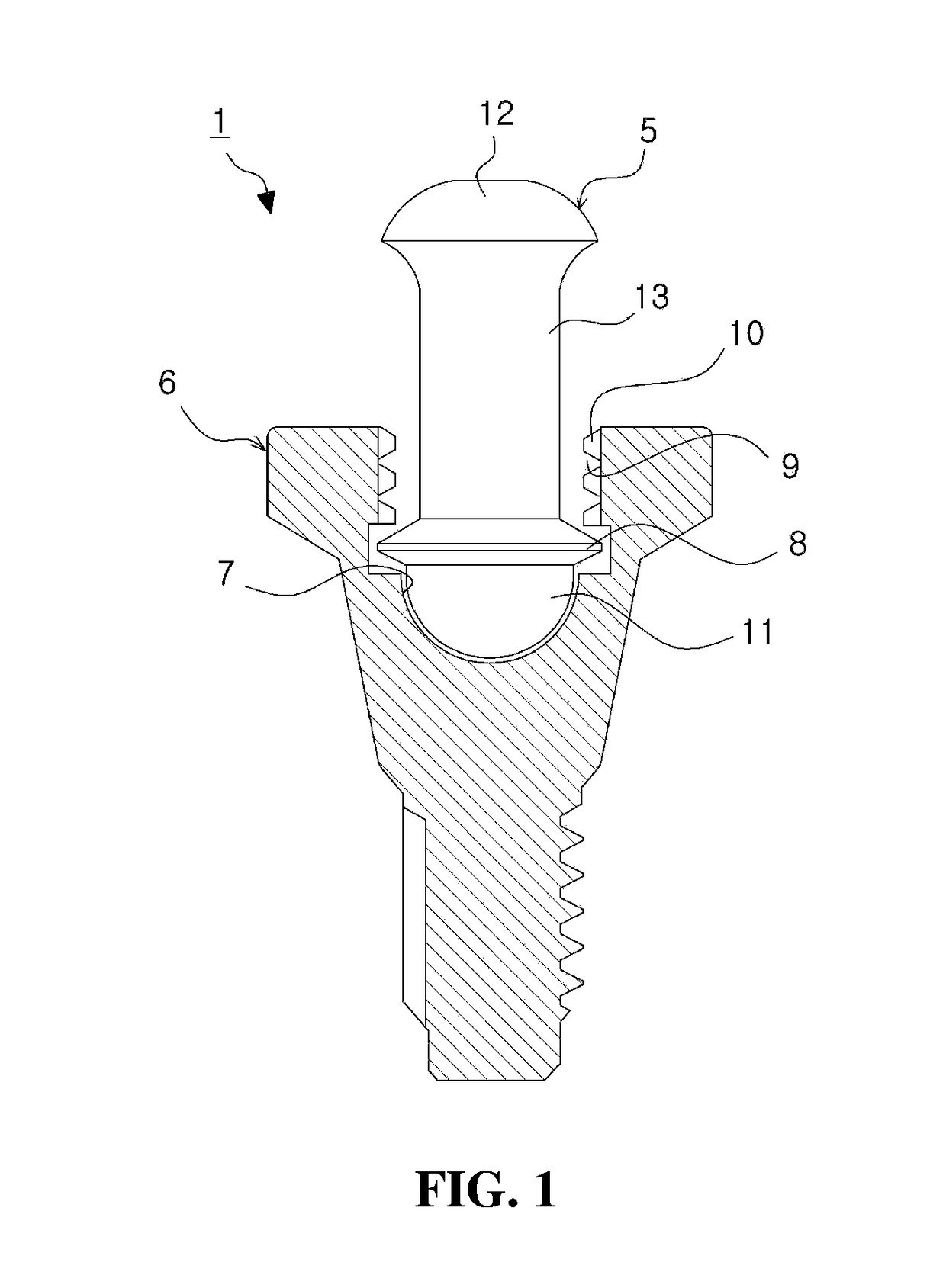 Denture fixing attachment