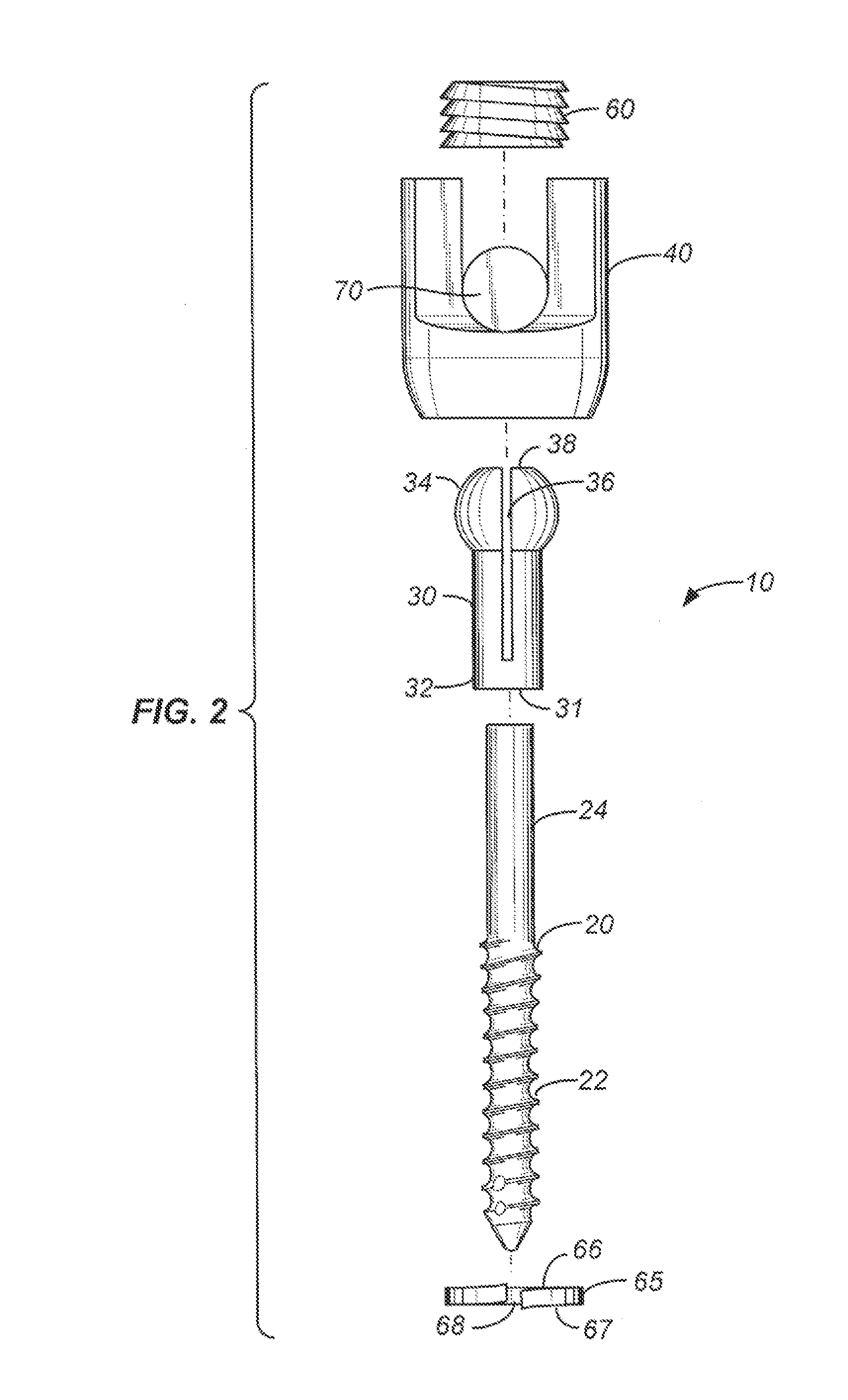 Variable height, multi-axial bone screw assembly
