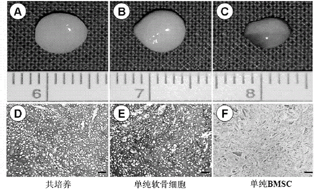 Human residual ear cartilage stem cells and method for constructing tissue engineered cartilage