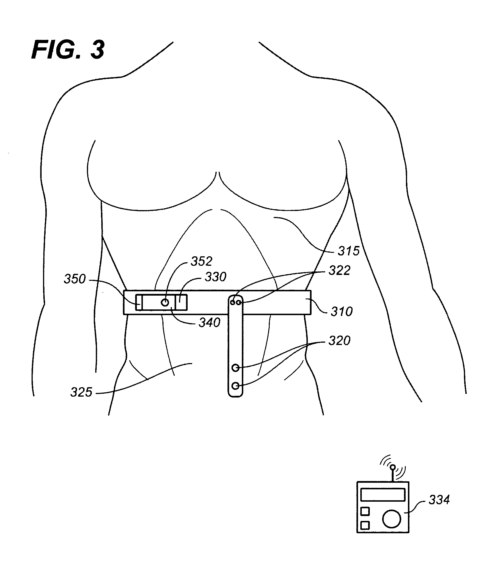 Apnea treatment device