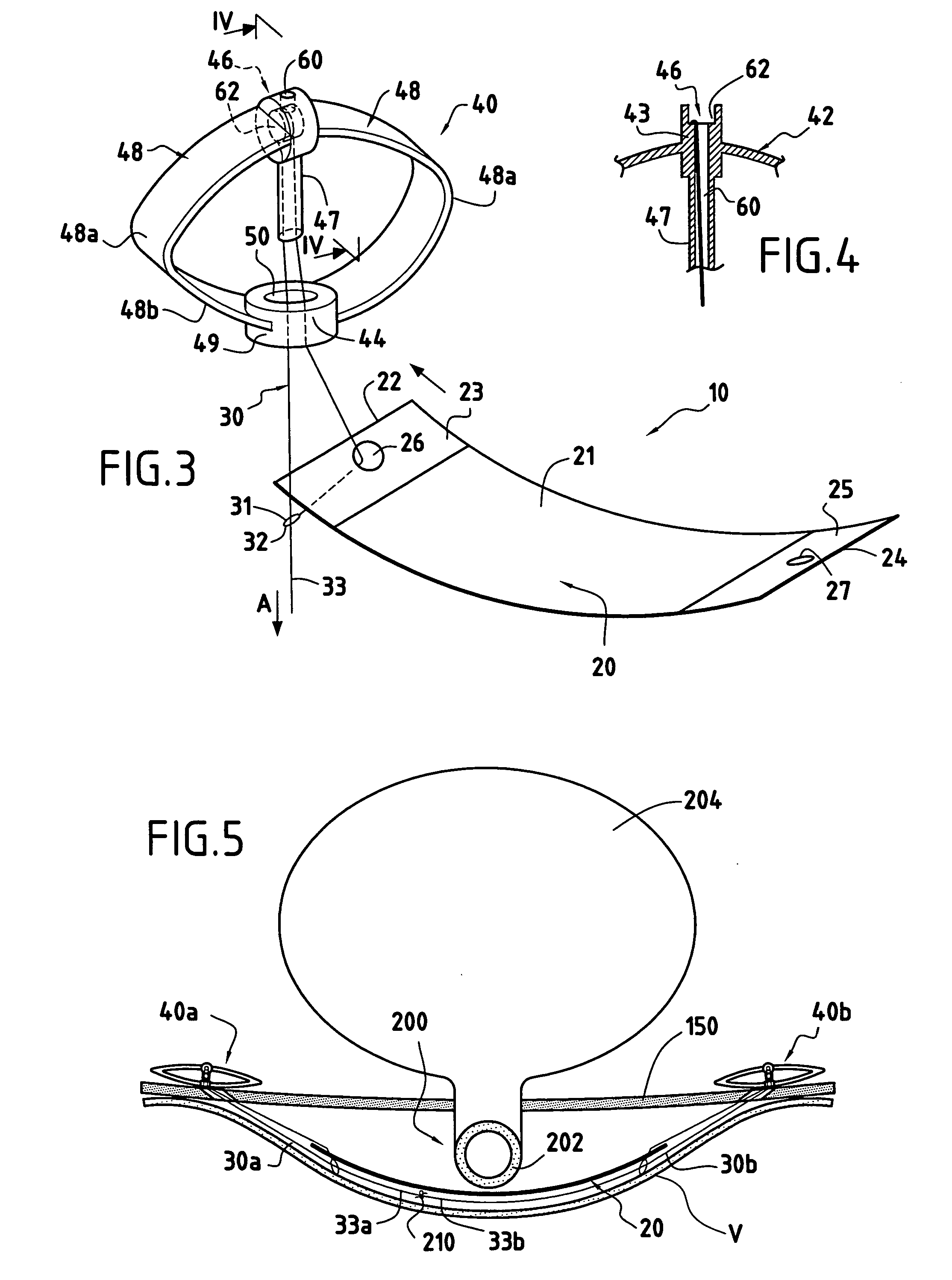 Surgical prosthesis-forming device used to implant an organ support in a mammal