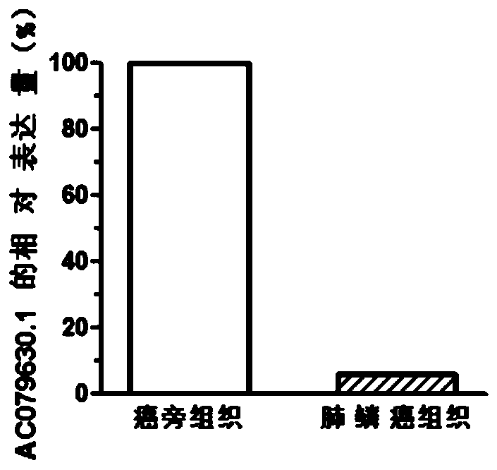 Biomarker and application thereof in lung cancer treatment