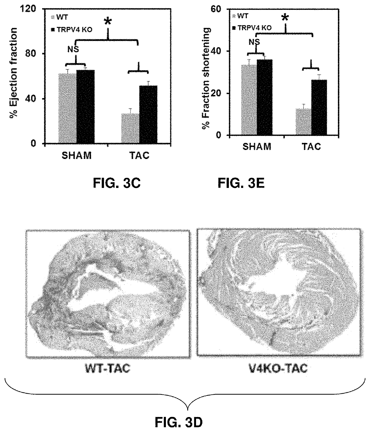 Methods for treating ischemic heart disease by targeting TRPV4