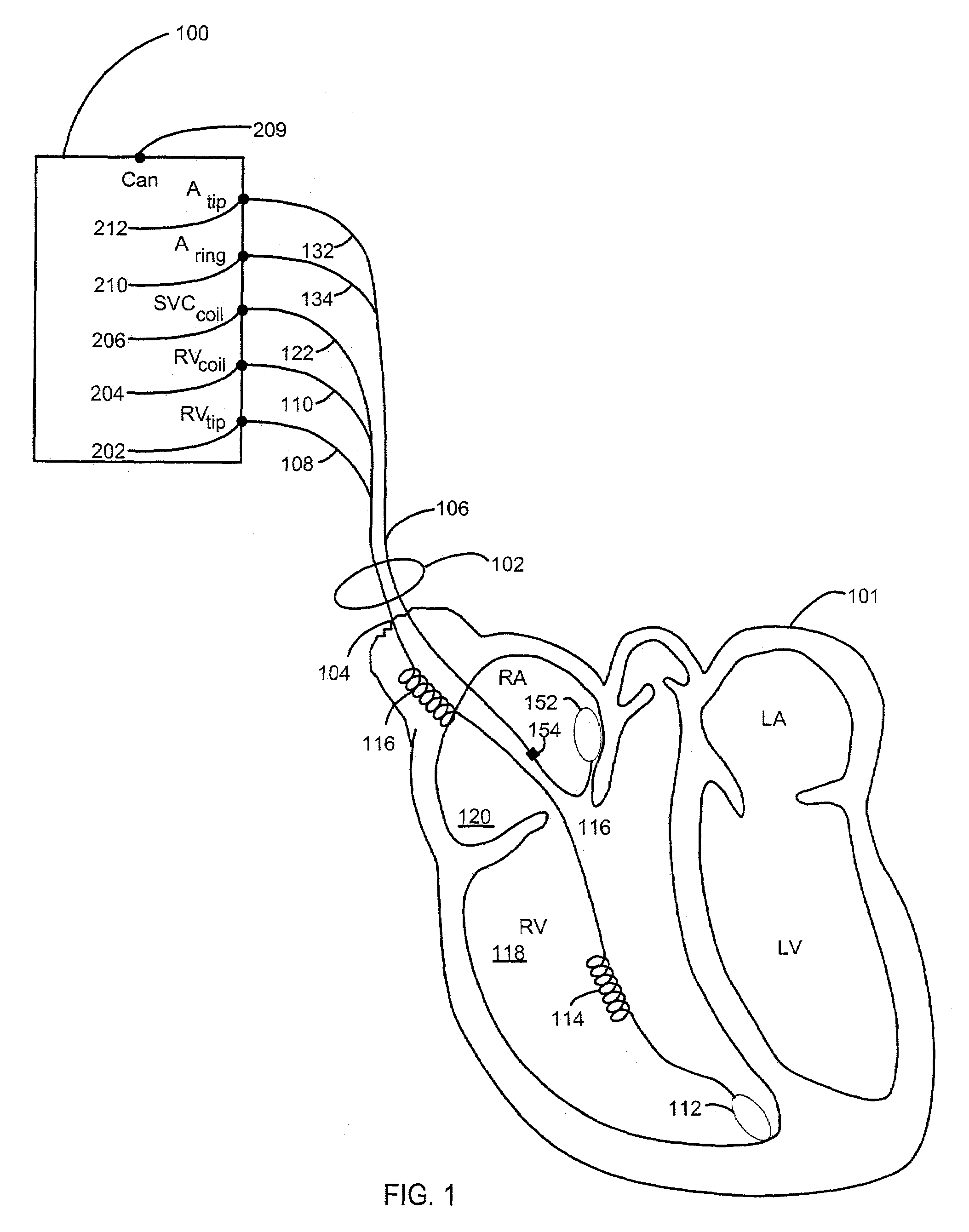 Method and system for characterizing a representative cardiac beat using multiple templates