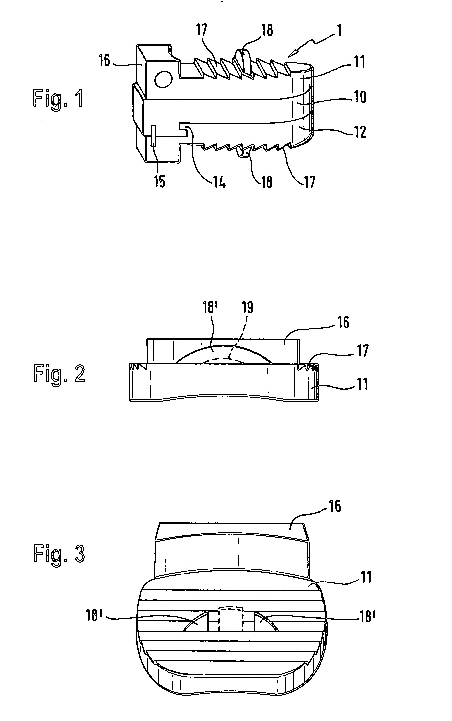 Cervical Intervertebral Disc Prosthesis Comprising An Anti-Dislocation Device And Instruments
