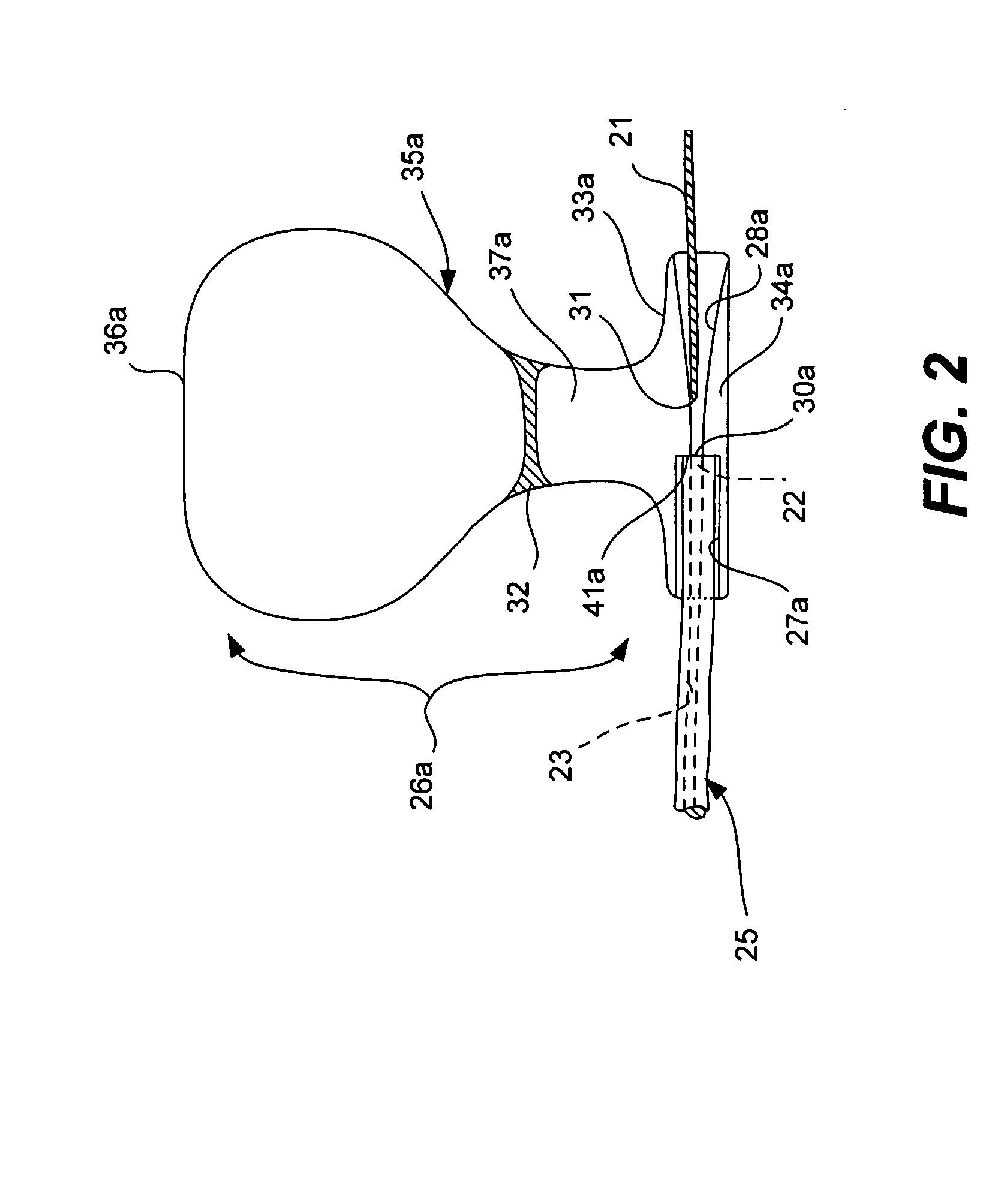 Guidewire loader apparatus and method