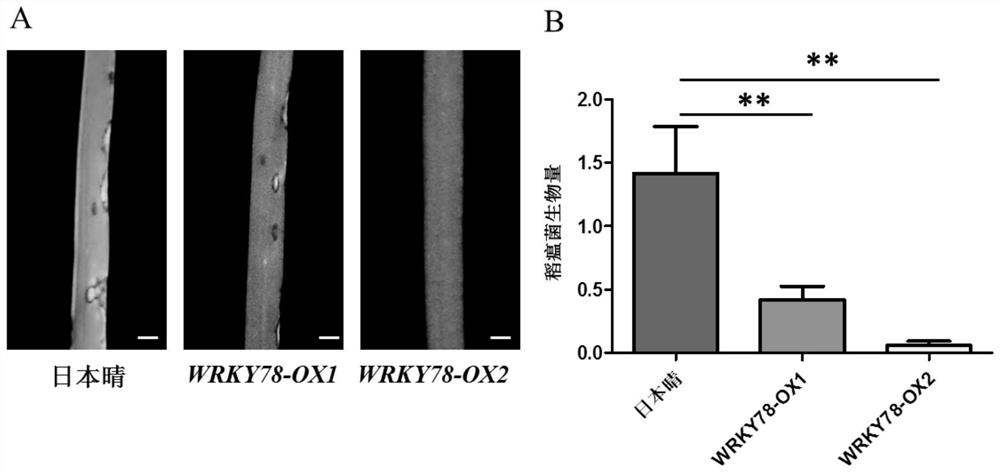 Application of protein WRKY78 to regulation of biological stress resistance of plants