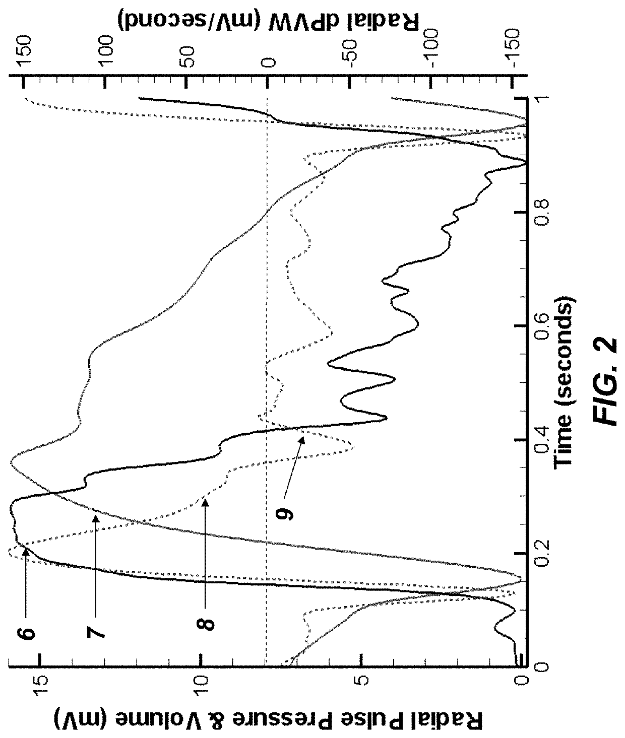 Method to Quantify the Hemodynamic and Vascular Properties in Vivo from Arterial Waveform Measurements