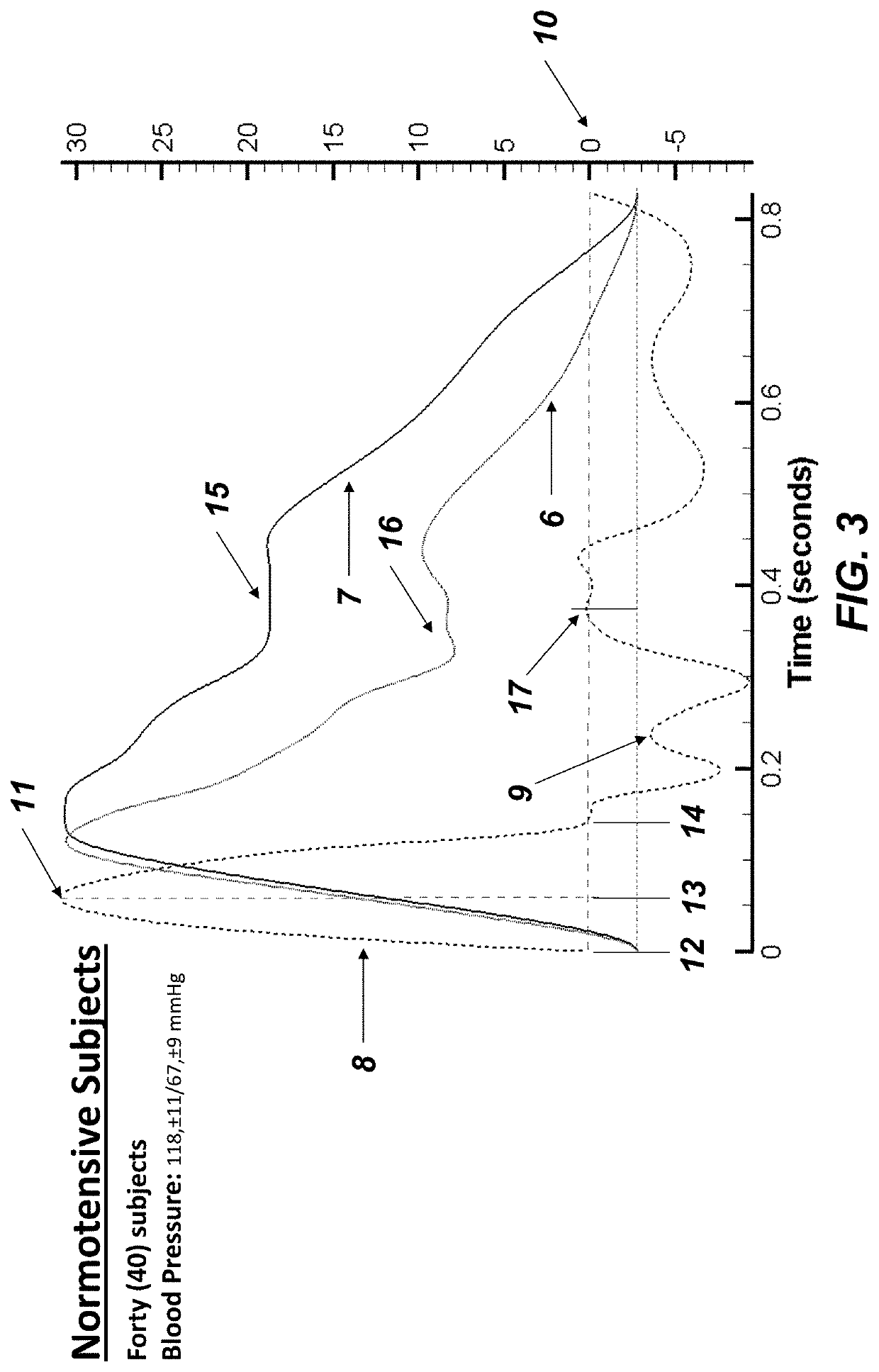 Method to Quantify the Hemodynamic and Vascular Properties in Vivo from Arterial Waveform Measurements