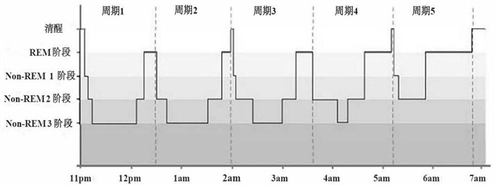 Non-invasive sensing sleep quality analysis system and method based on fuzzy inference system