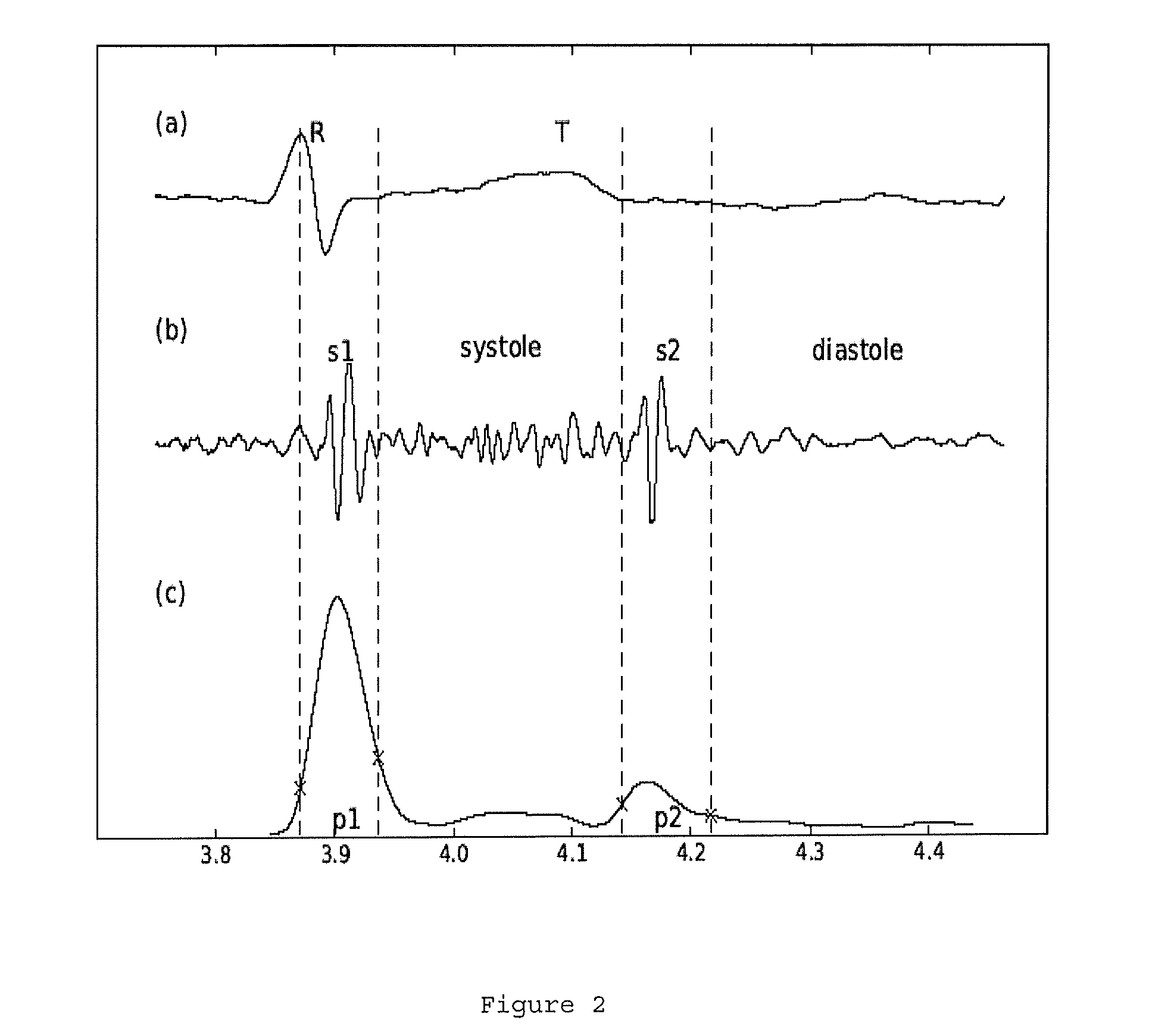 System and method for classifying a heart sound