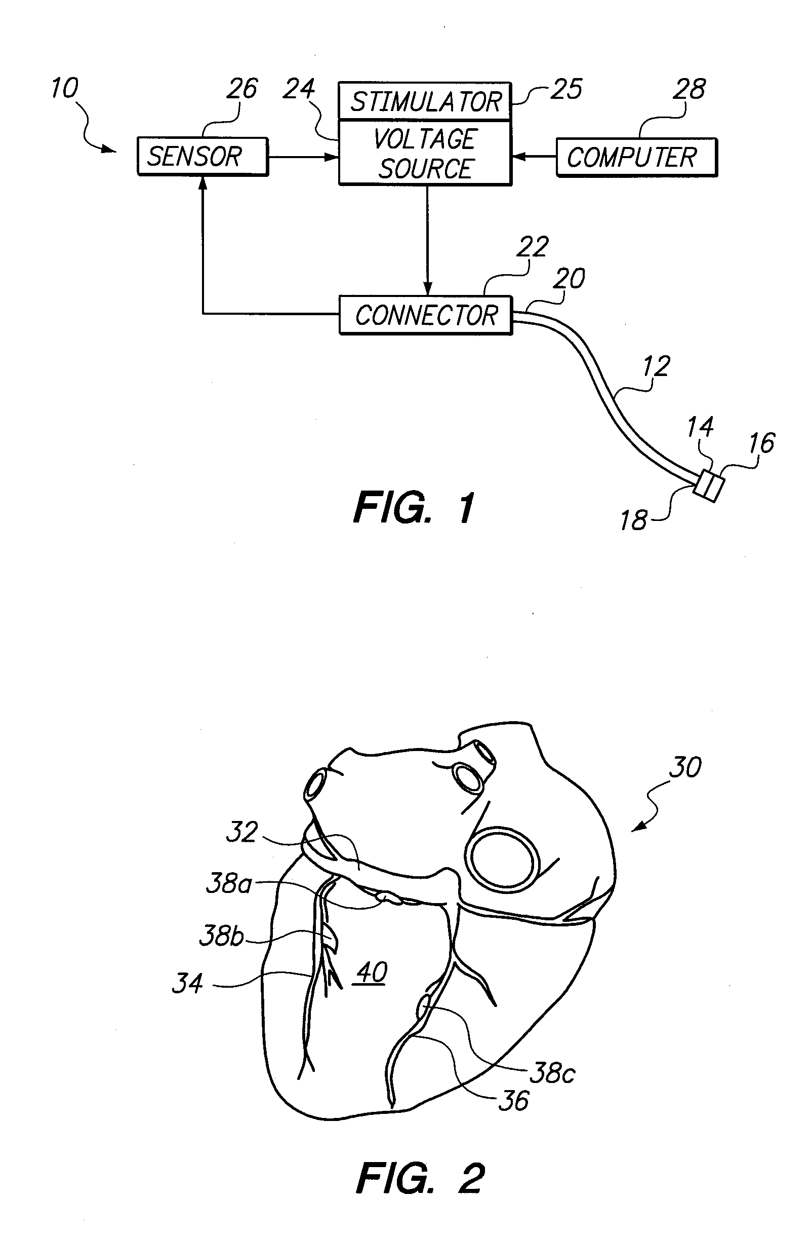 System and Method for Transvascular Activation of Cardiac Nerves with Automatic Restart