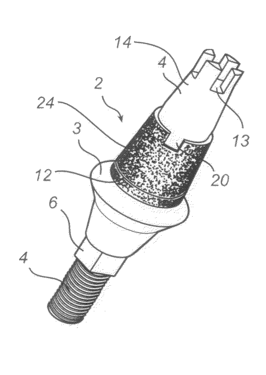 Dental implant, abutment structure and method for implanting a dental implant